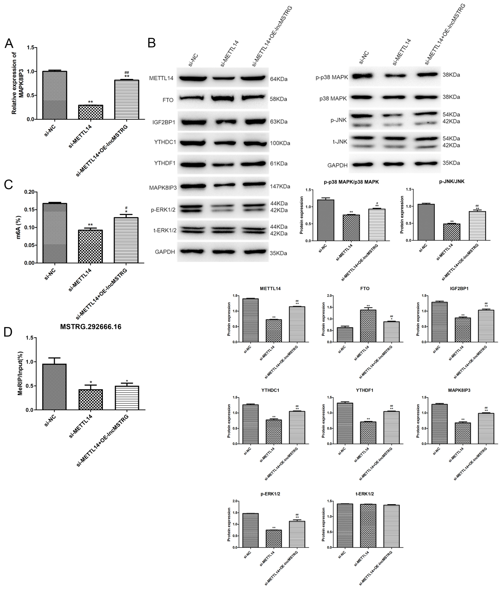 Poor Core Functionality METTL14-Mediated lncRNA MSTRG.292666.16 m6A Modification Promotes the ...