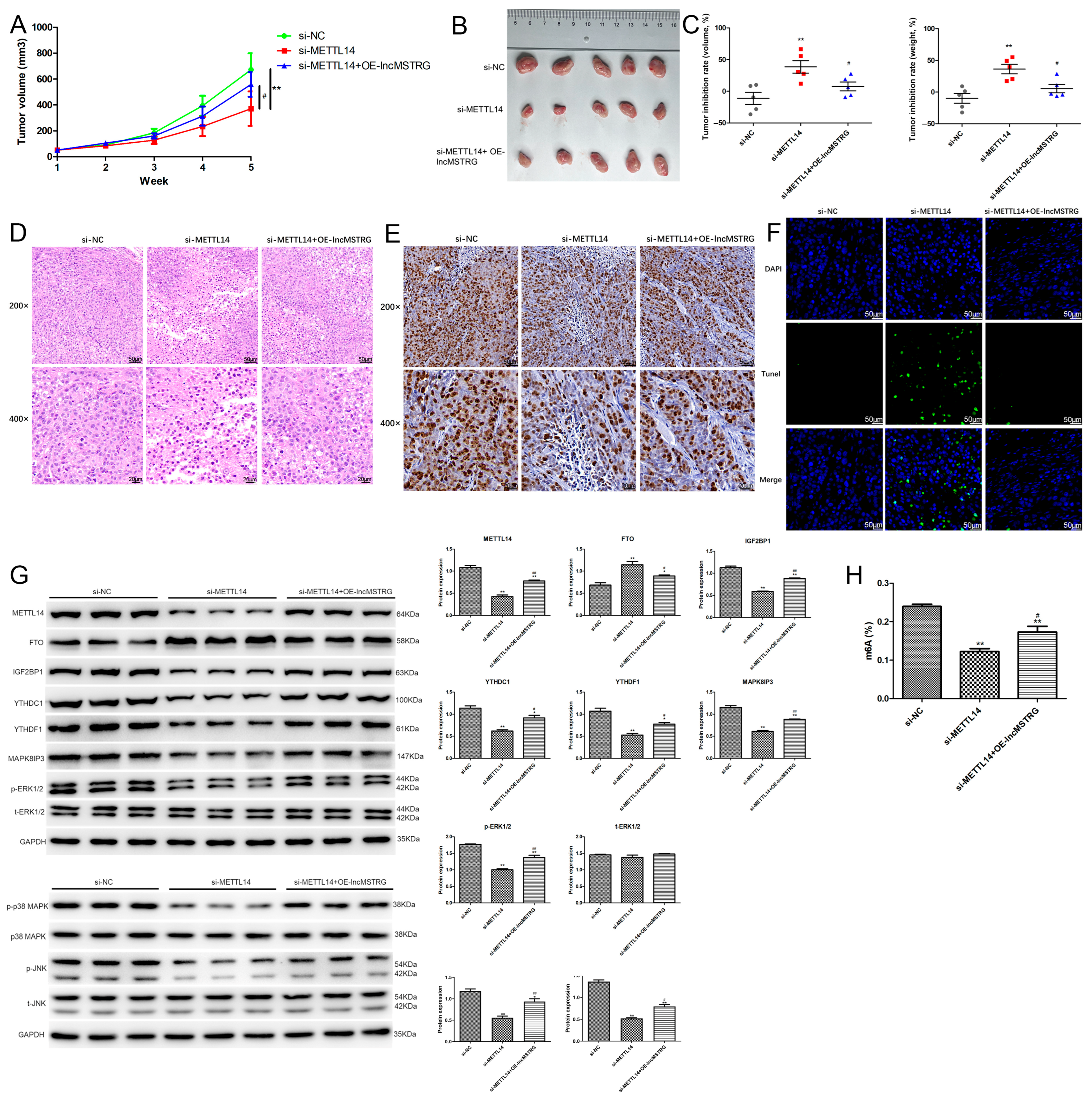 Poor Core Functionality METTL14-Mediated lncRNA MSTRG.292666.16 m6A Modification Promotes the ...