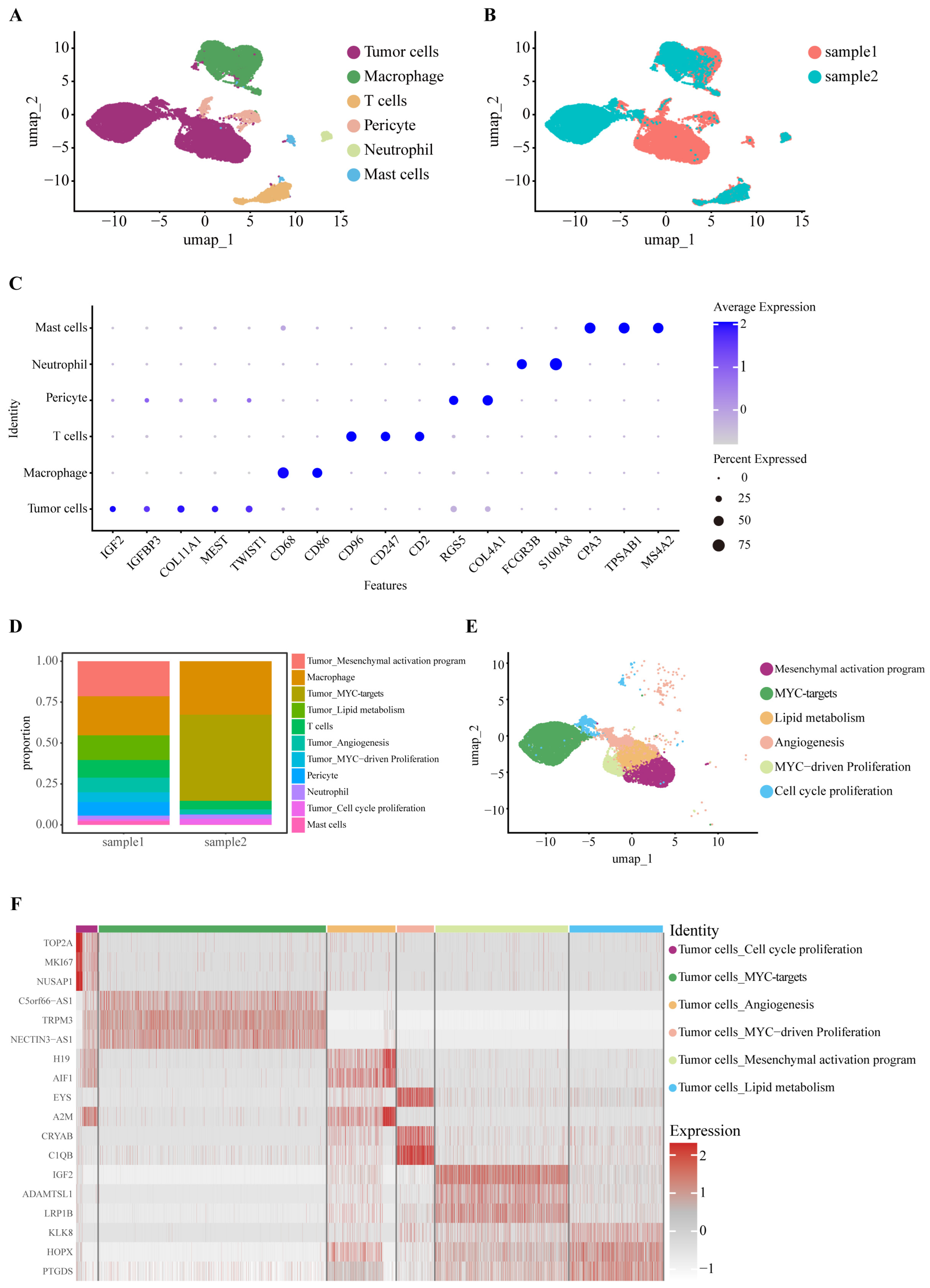 Landscape Architecture Notes.pdf TOP2A Overexpression as a Prognostic Biomarker in High-Grade Meningioma ...