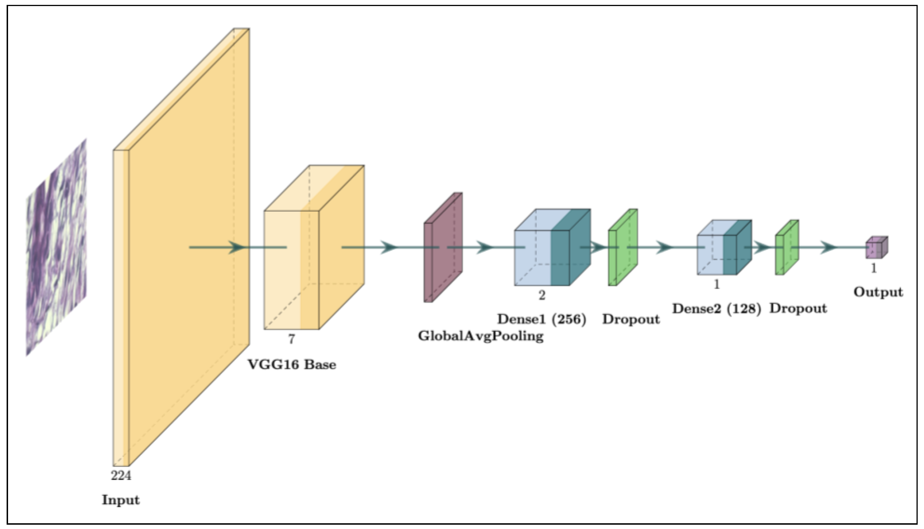 Application of VGG16 Transfer Learning for Breast Cancer Detection