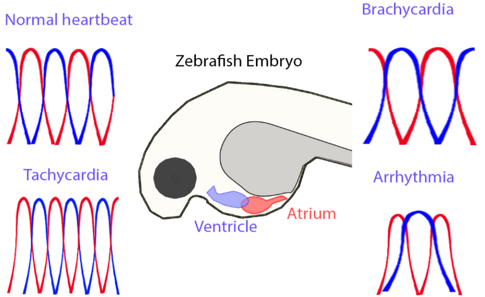 Inventions | Free Full-Text | A Simple ImageJ-Based Method to Measure  Cardiac Rhythm in Zebrafish Embryos