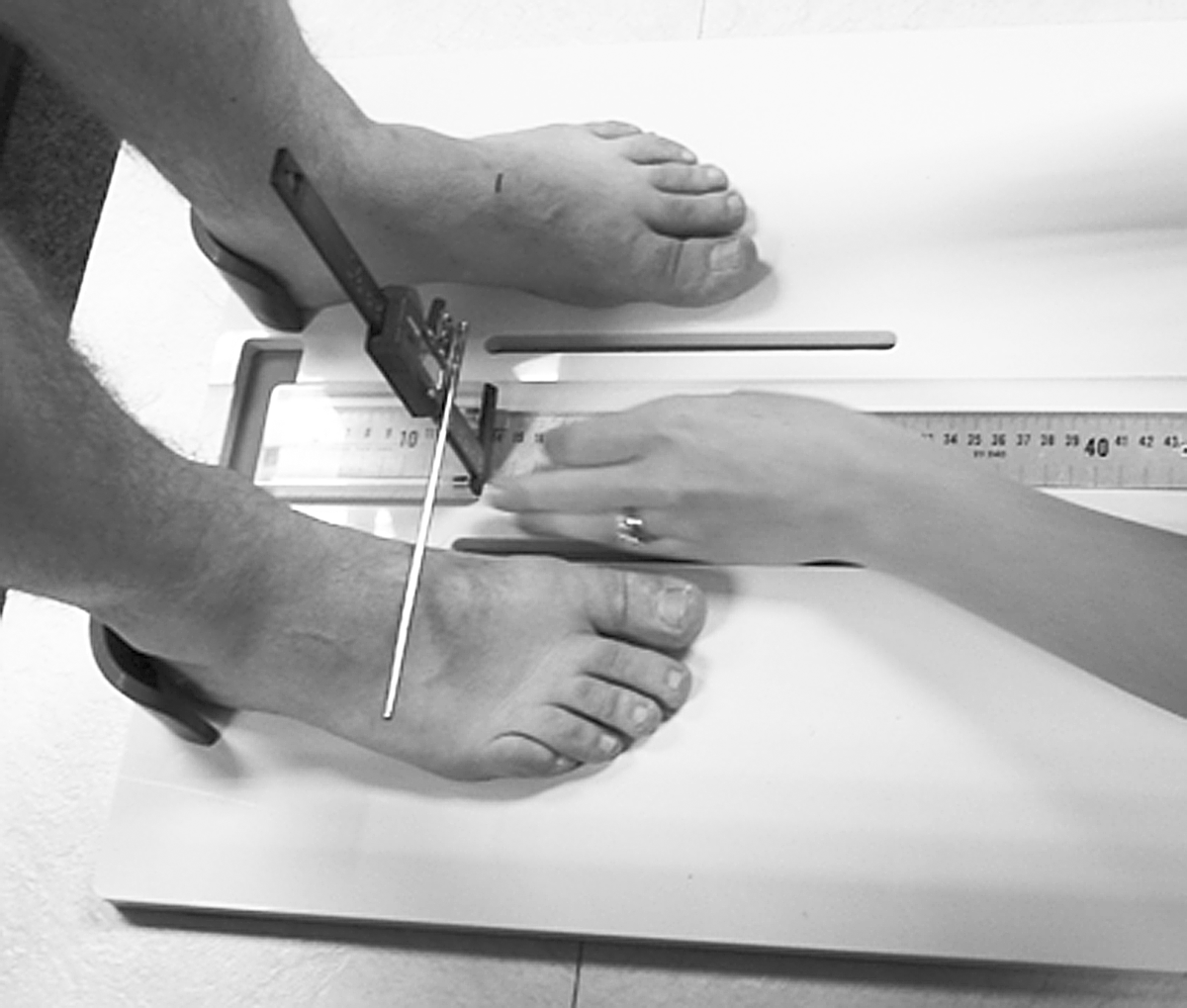Static Foot Does Foot Placement Affect the Reliability of Static Foot Posture ...