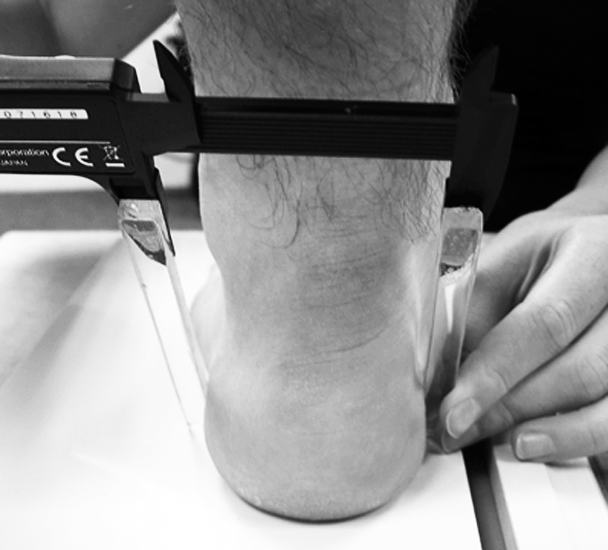 Static Foot Does Foot Placement Affect the Reliability of Static Foot Posture ...