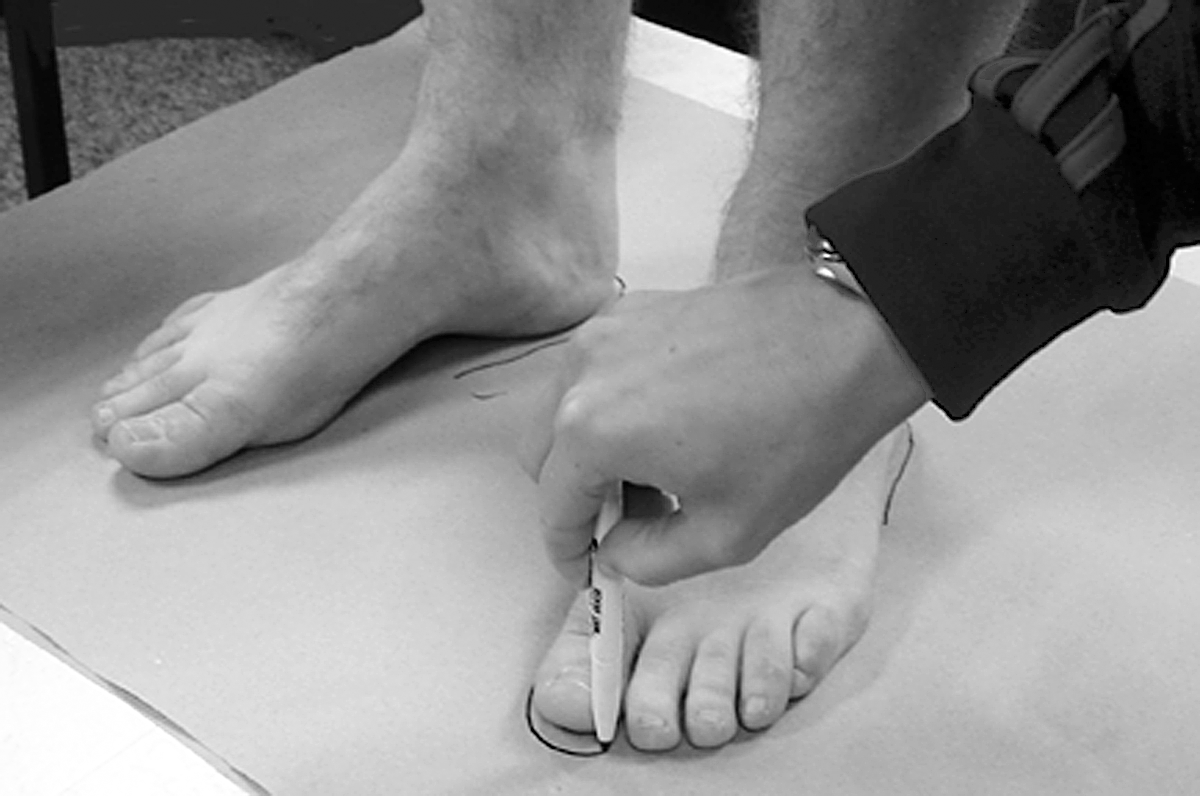 Static Foot Does Foot Placement Affect the Reliability of Static Foot Posture ...