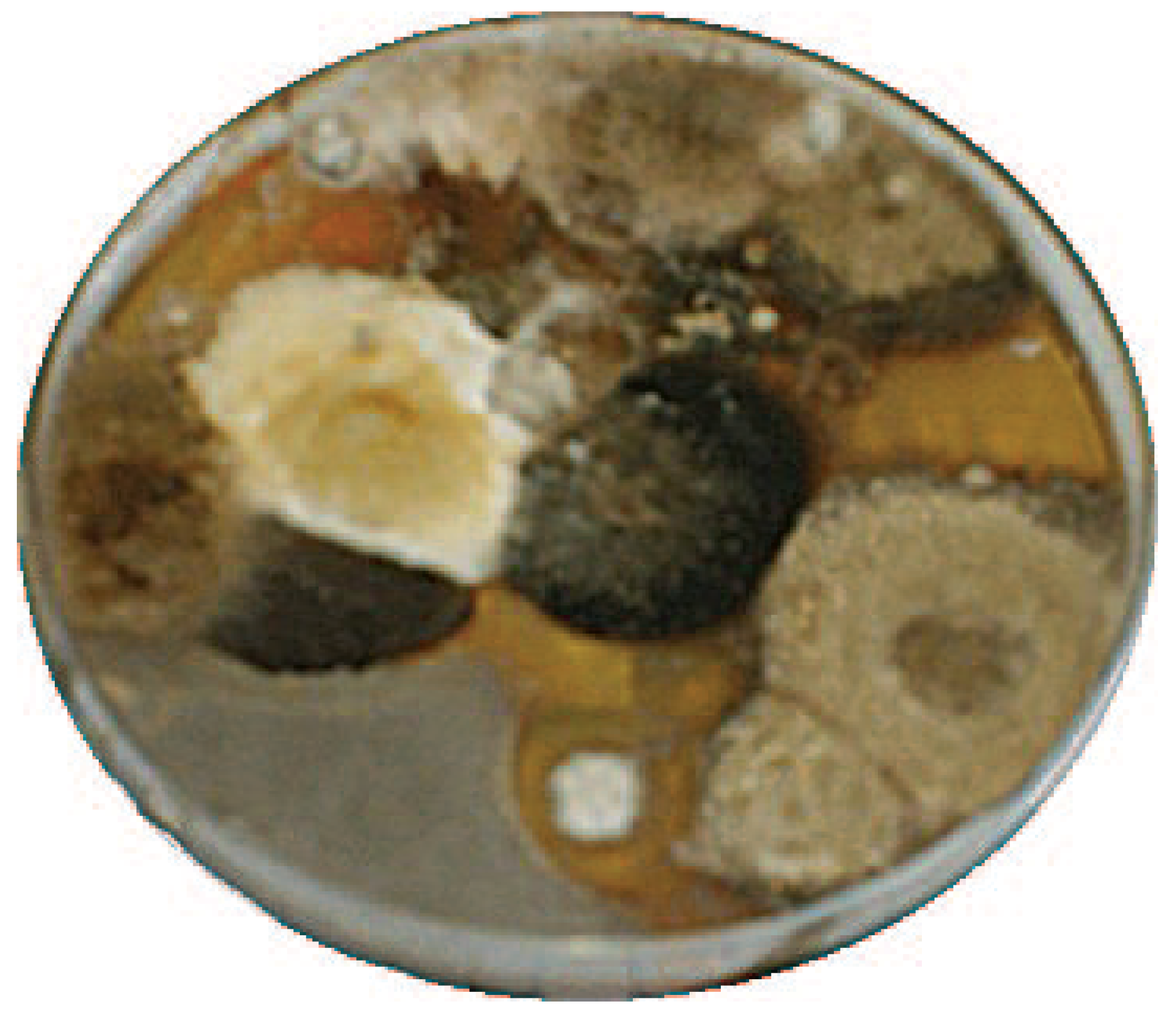 Isolation of Dermatophytes (and Other Fungi) from Human Nail and Skin ...