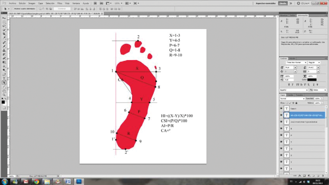 Footprint Chart Html Reliability and Validity of the Footprint Assessment Method Using ...