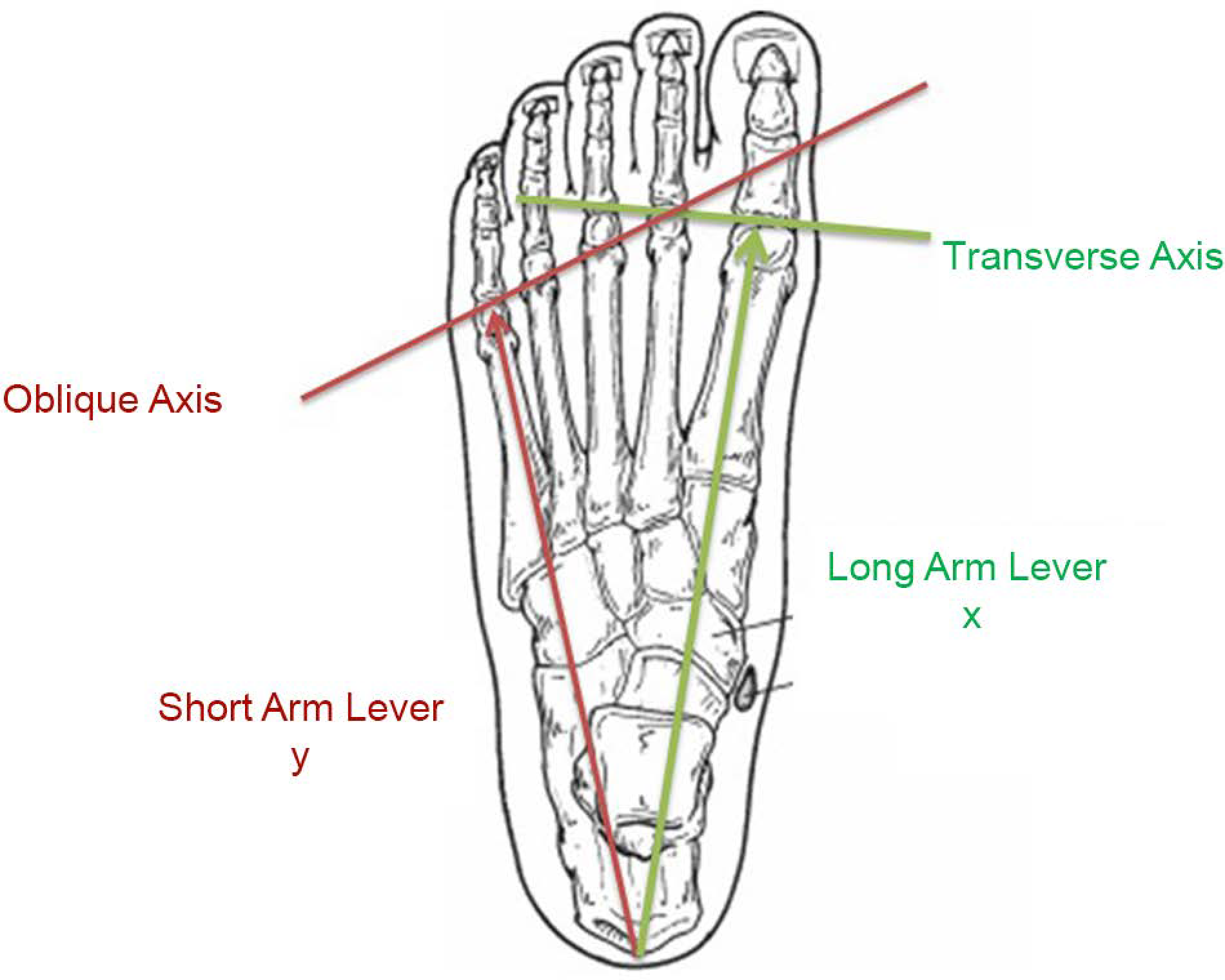 Ref Toe System Theory of the Biomechanical Evolution of the Rheumatoid Foot: A ...