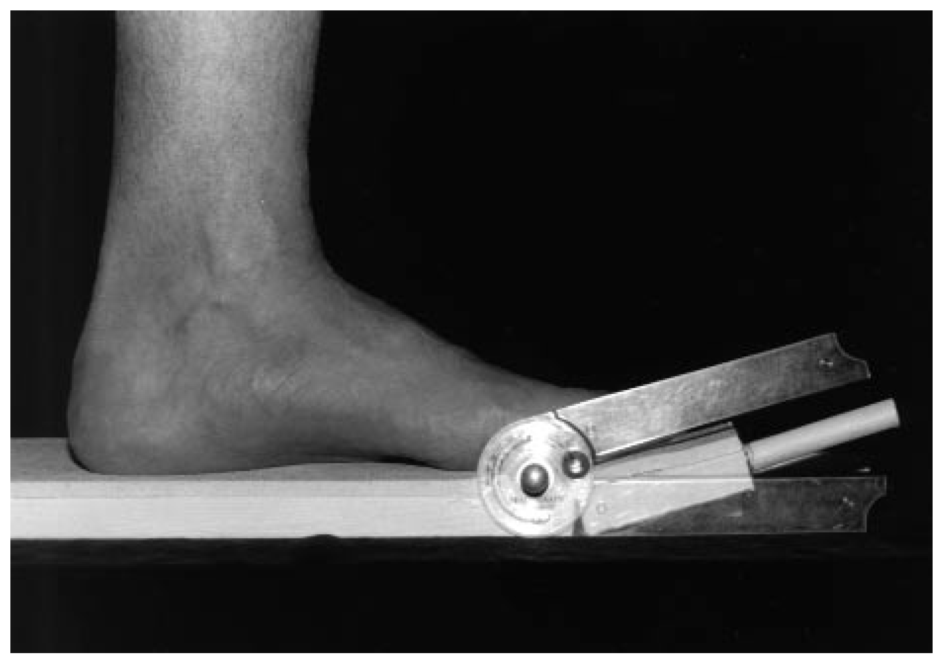 Position of the first ray and motion of the first metatarsophalangeal joint