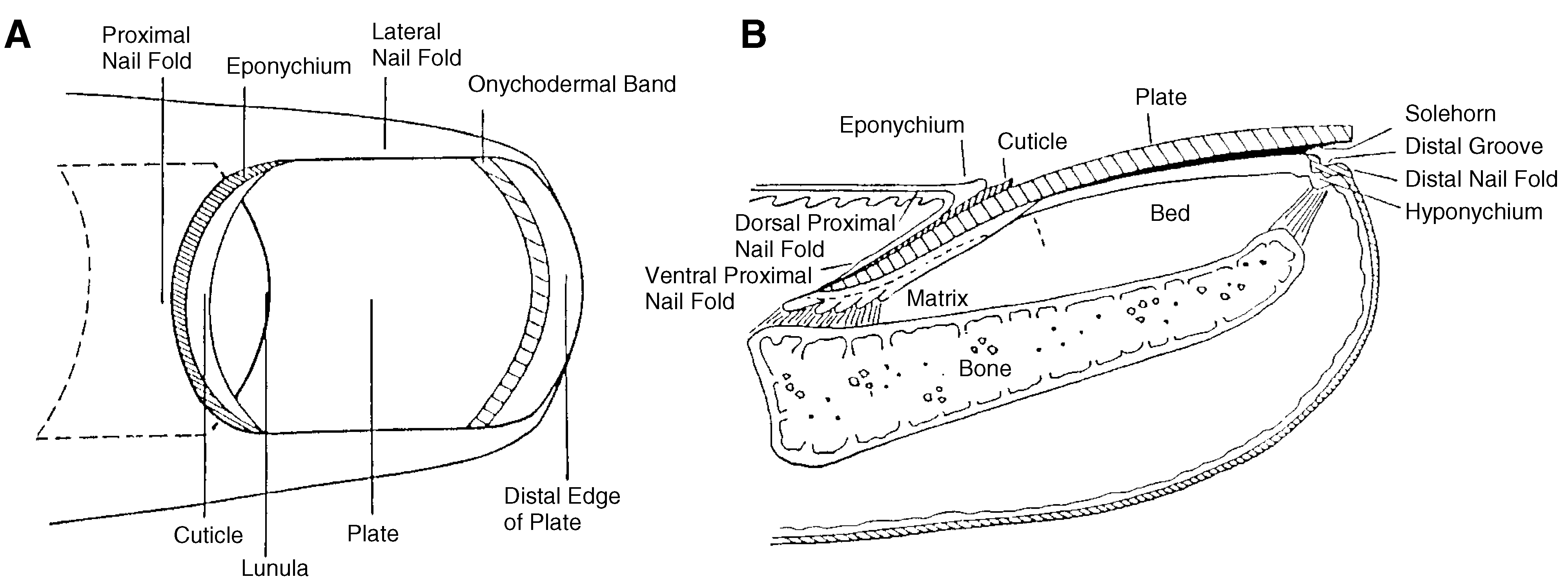 Mozena Classification The Mozena Classification System and Treatment Algorithm for Ingrown ...