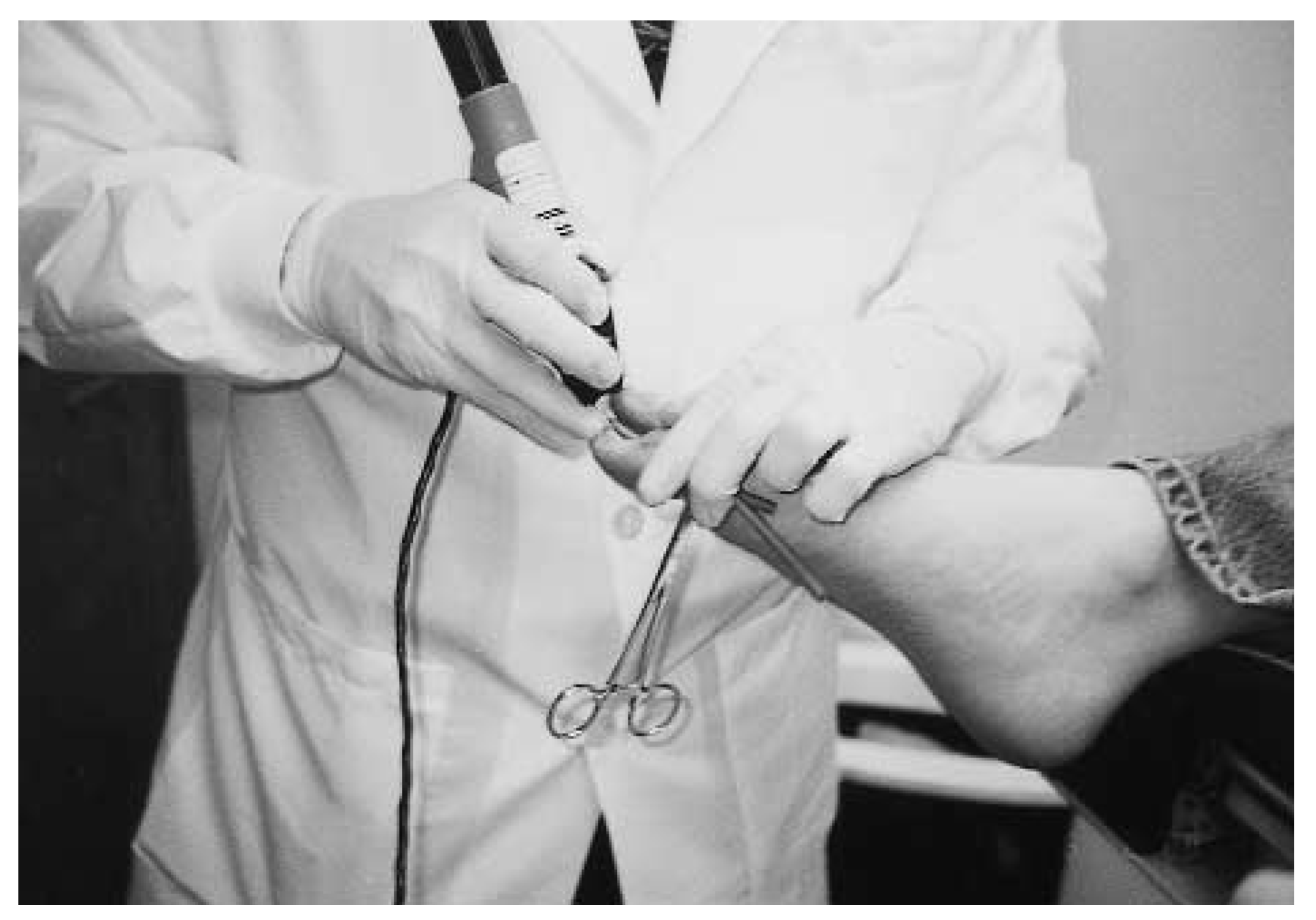 Mozena Classification The Mozena Classification System and Treatment Algorithm for Ingrown ...