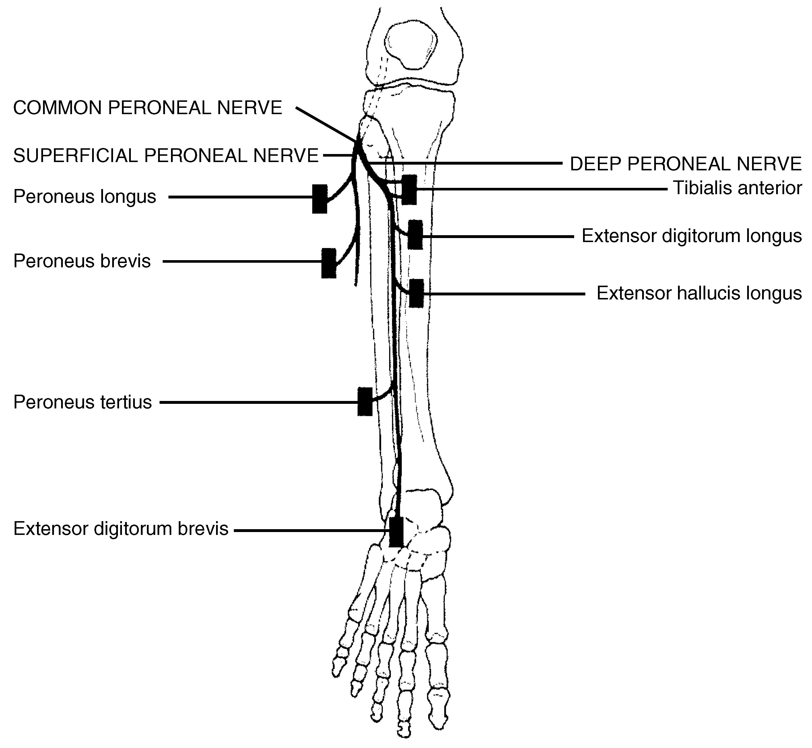 Common Neurologic Disorders Affecting the Foot