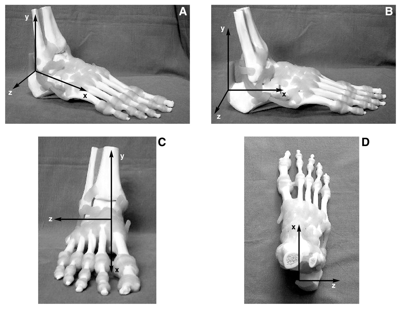 Metatarsal Modifiers Clinical and Experimental Models of the Midtarsal Joint. Proposed Terms ...