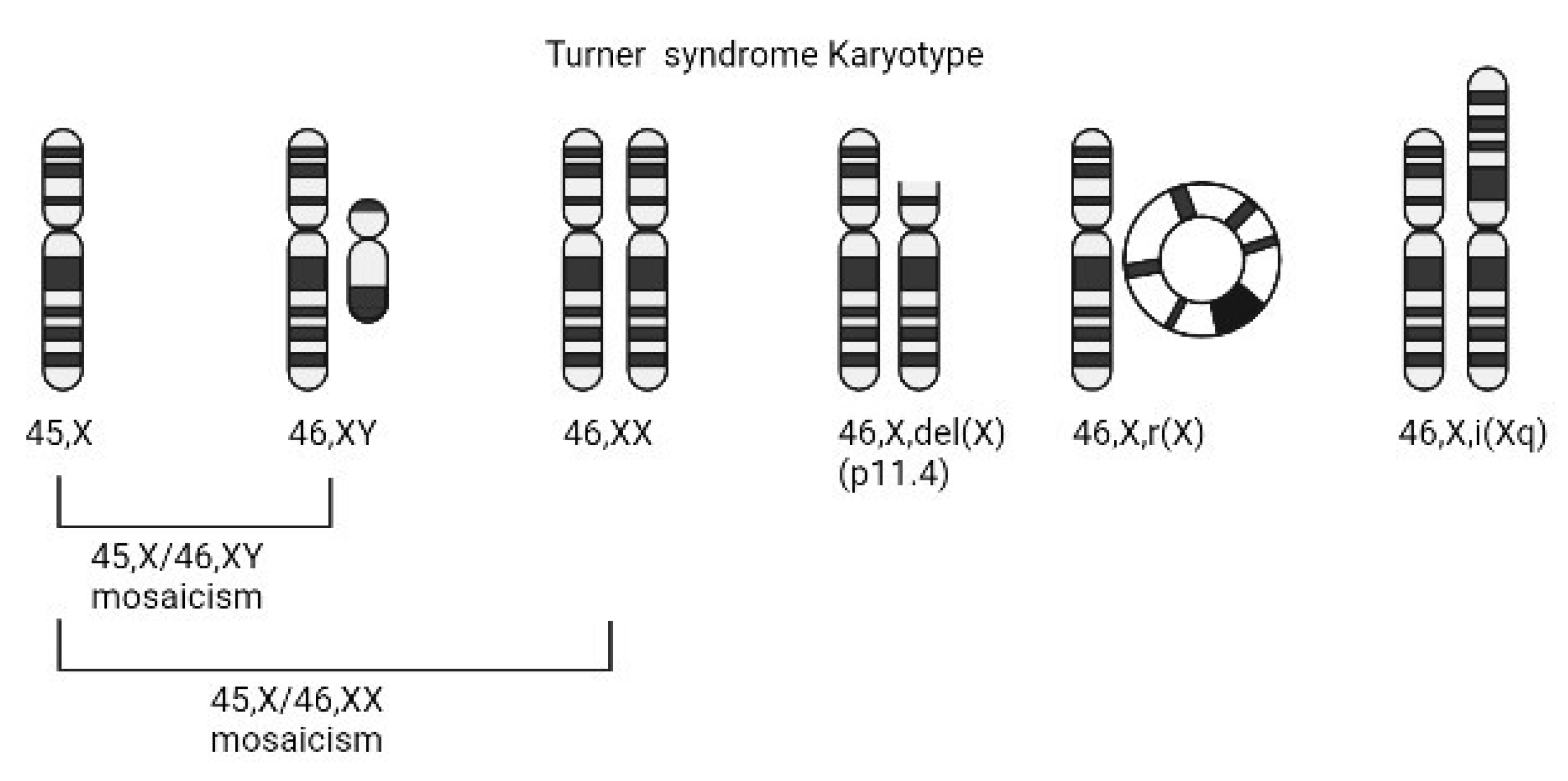 women with turner syndrome