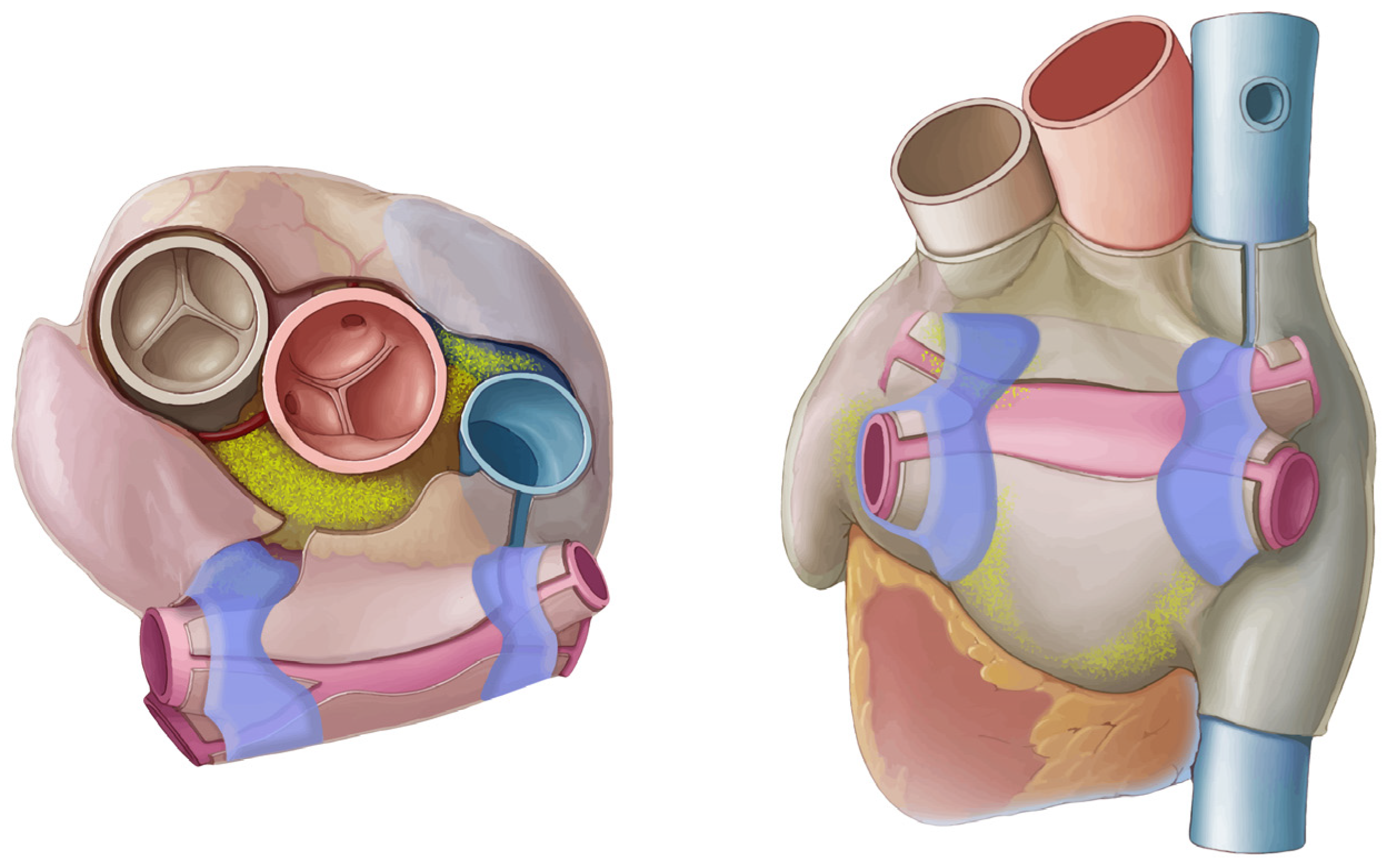 Left): Porcine ventricle sample, epicardium side up, mounted to