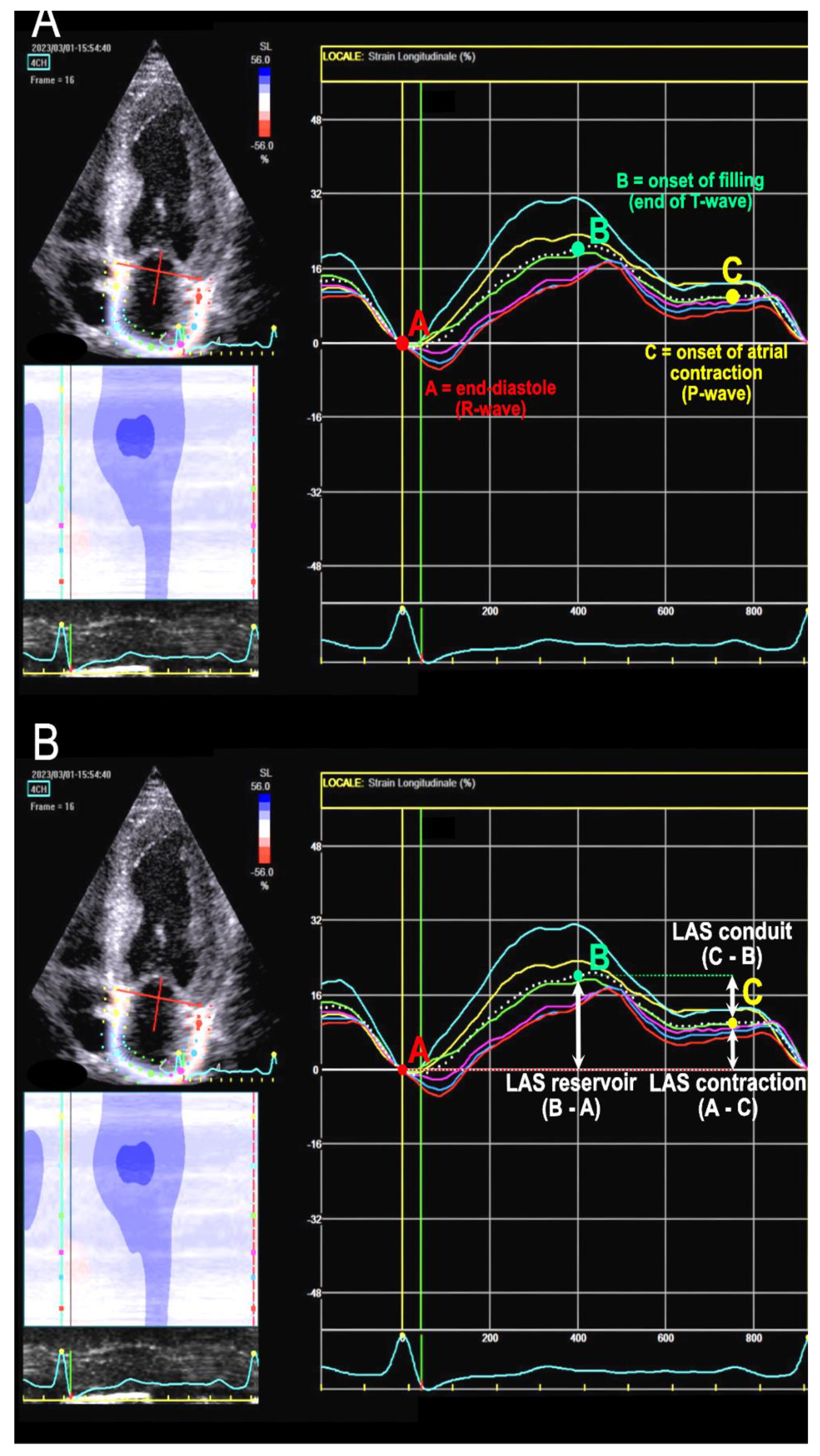Left Atrial Strain Determinants During the Cardiac Phases