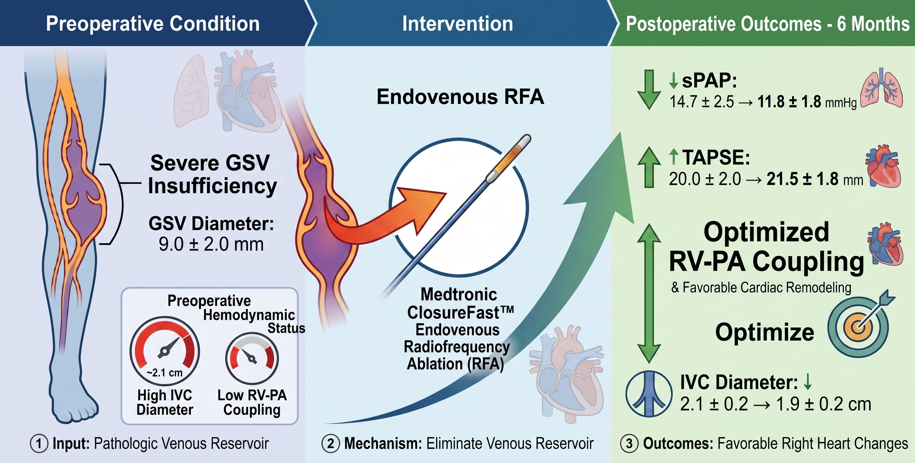 Effects of Endovenous Radiofrequency Ablation on Right Ventricular ...