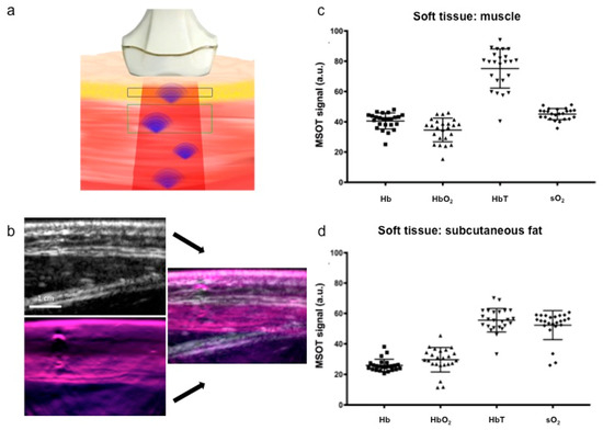 Multispectral Optoacoustic Tomography: Intra- and Interobserver ...