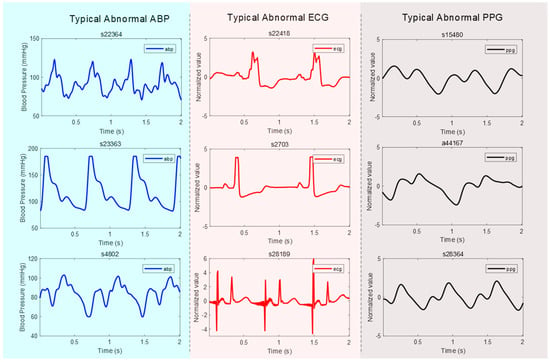 JCM | Free Full-Text | How Effective Is Pulse Arrival Time for ...