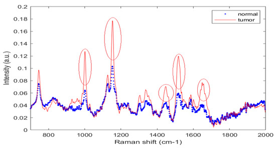 Raman Spectroscopy Analysis for Optical Diagnosis of Oral Cancer Detection