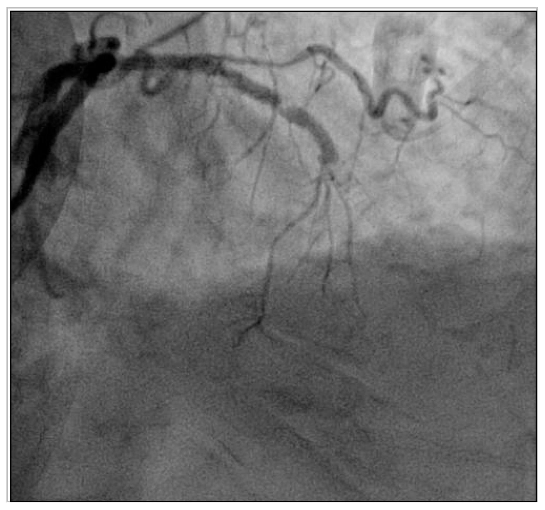 JCM | Free Full-Text | Optimal Antithrombotic Treatment Of Patients ...