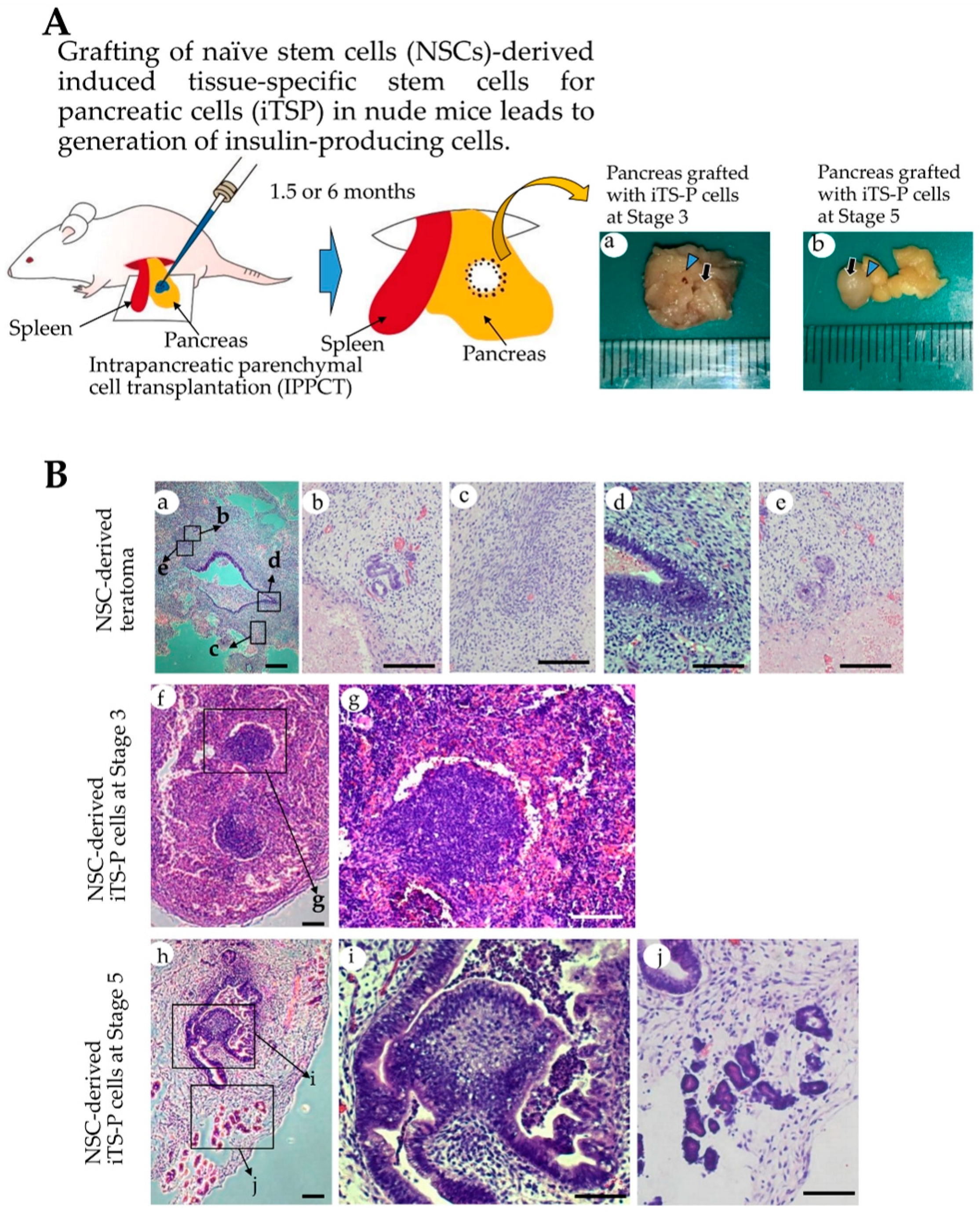 JCM | Free Full-Text | Drug-Induced Naïve iPS Cells Exhibit Better  Performance than Primed iPS Cells with Respect to the Ability to  Differentiate into Pancreatic β-Cell Lineage