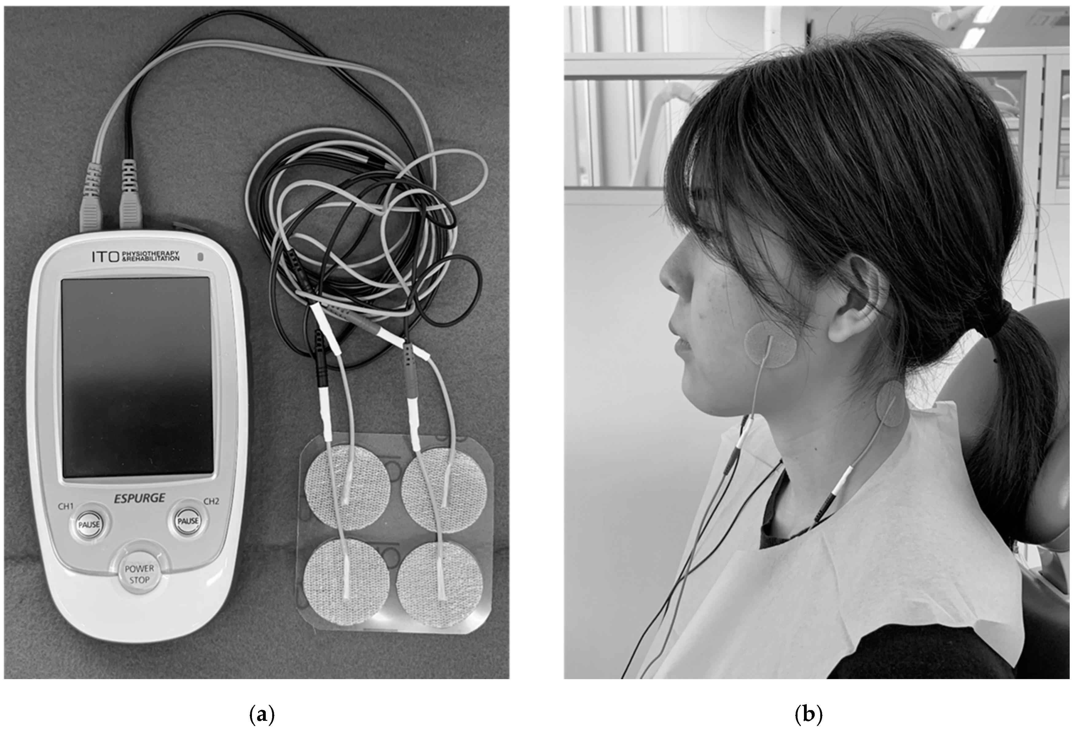 Transcutaneous electrical nerve stimulation (TENS) therapy - Emotions Market