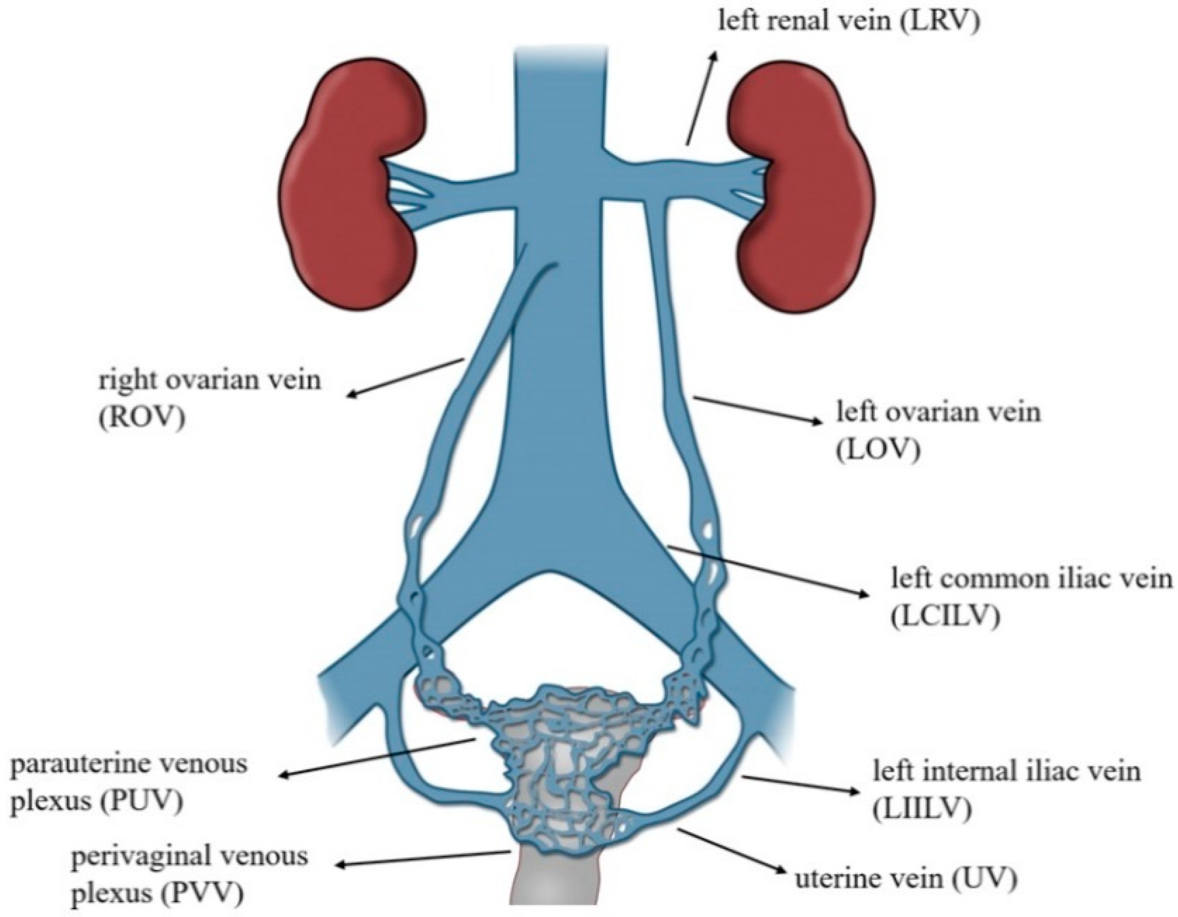 Chronic venous outflow obstruction: An important cause of chronic