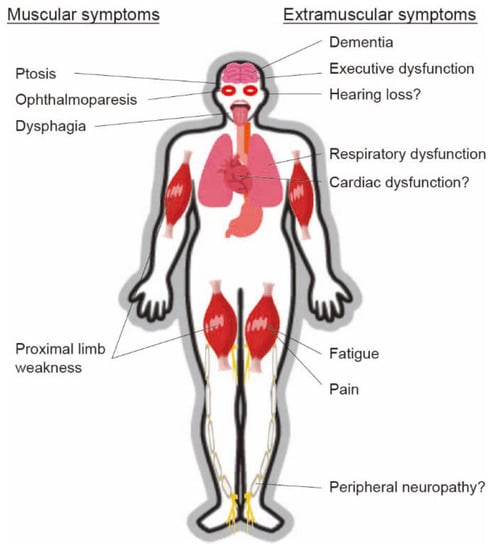 Recent Progress in Oculopharyngeal Muscular Dystrophy