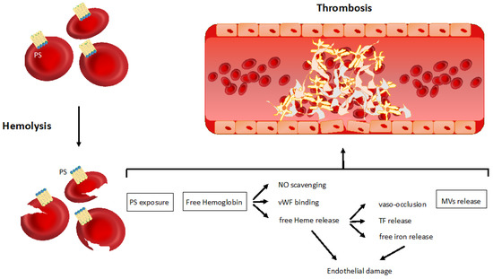 JCM | Free Full-Text | Thrombotic Complications in Patients with Immune ...