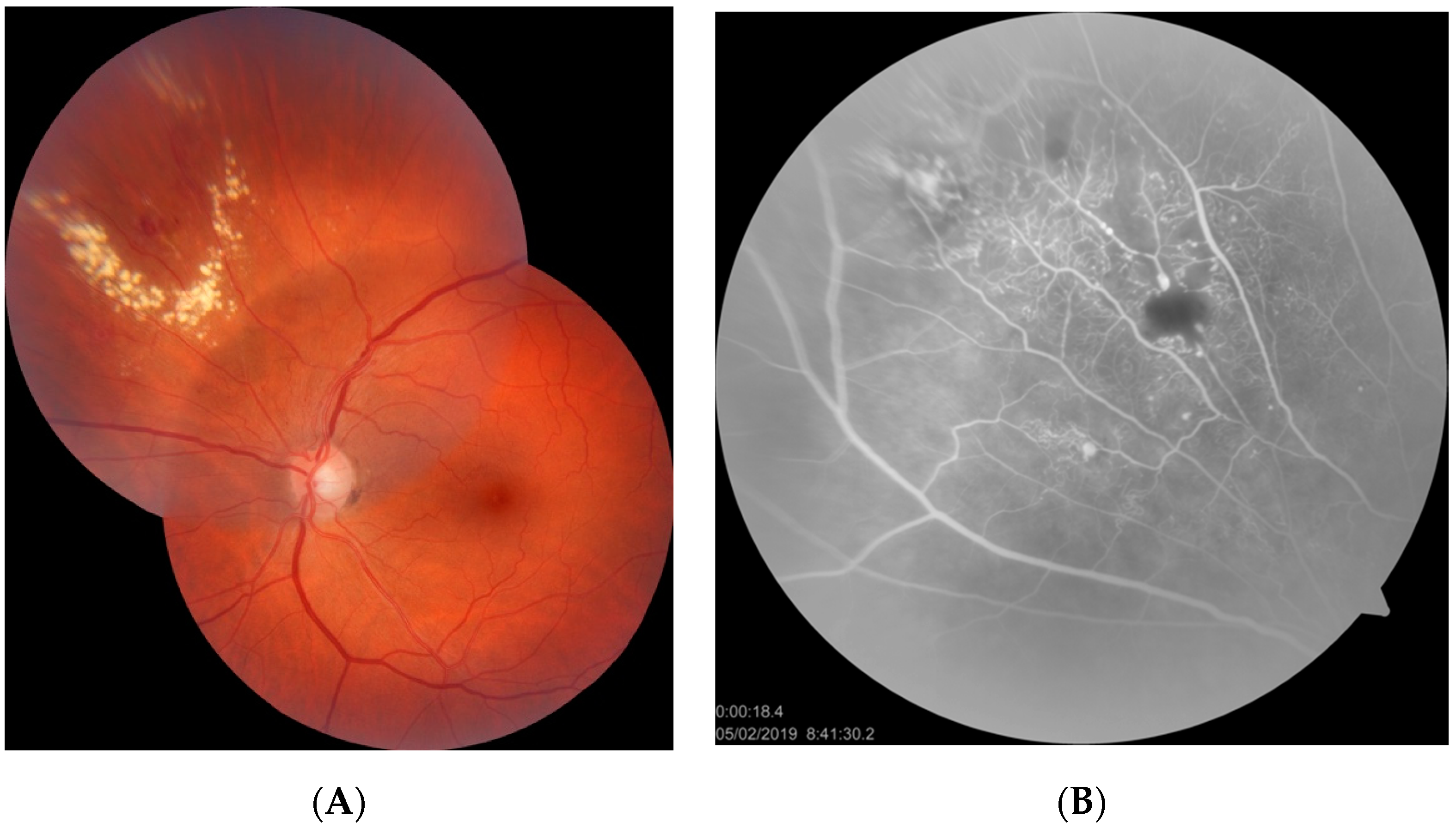 What is the Retina?  Review of the Retina