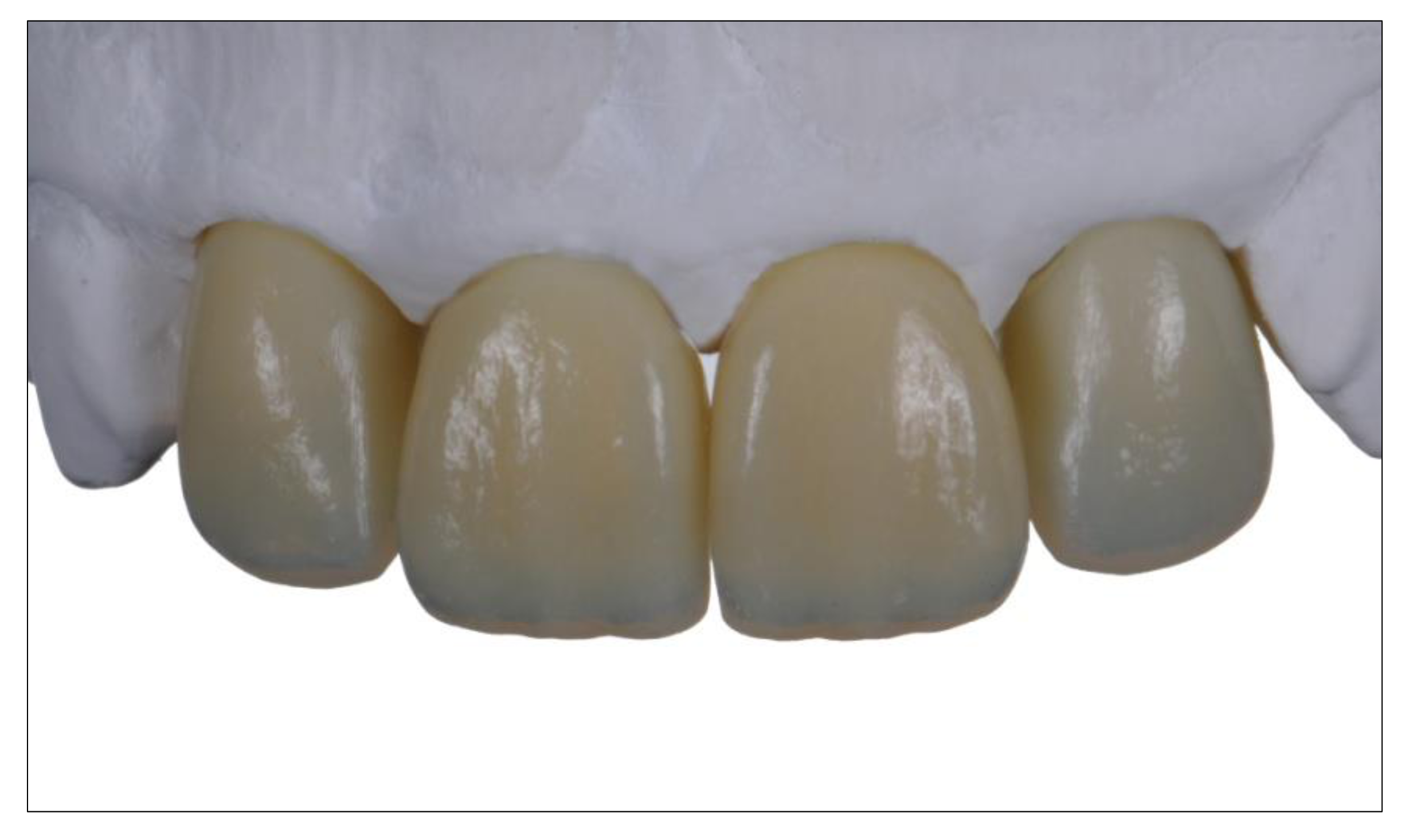 JCM | Free Full-Text | 3D in Digital Prosthetic Dentistry: Overview of Developments in Additive Manufacturing