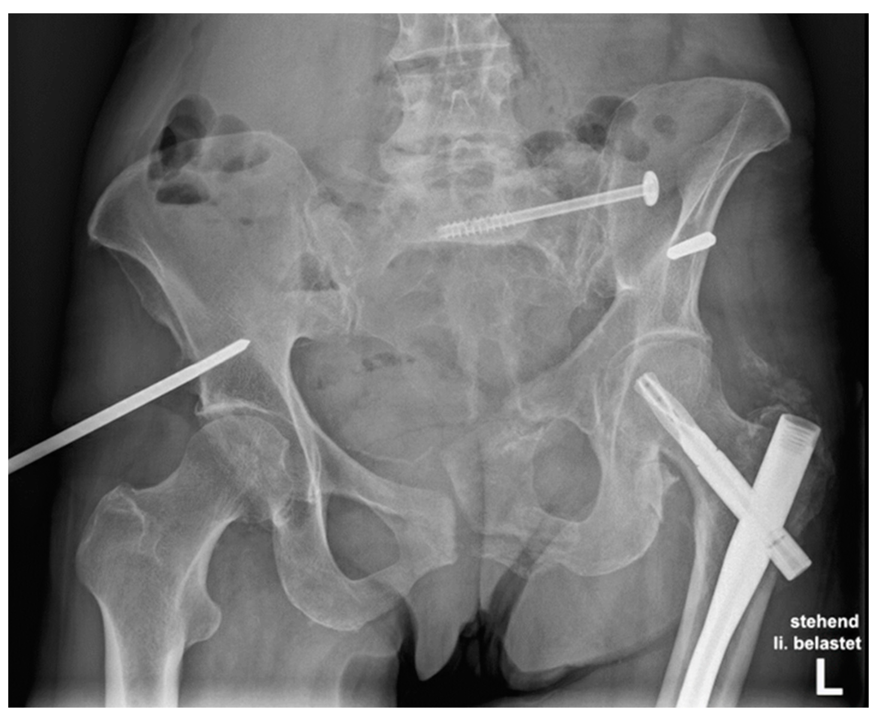 The Pelvis and Hips | Radiology Key