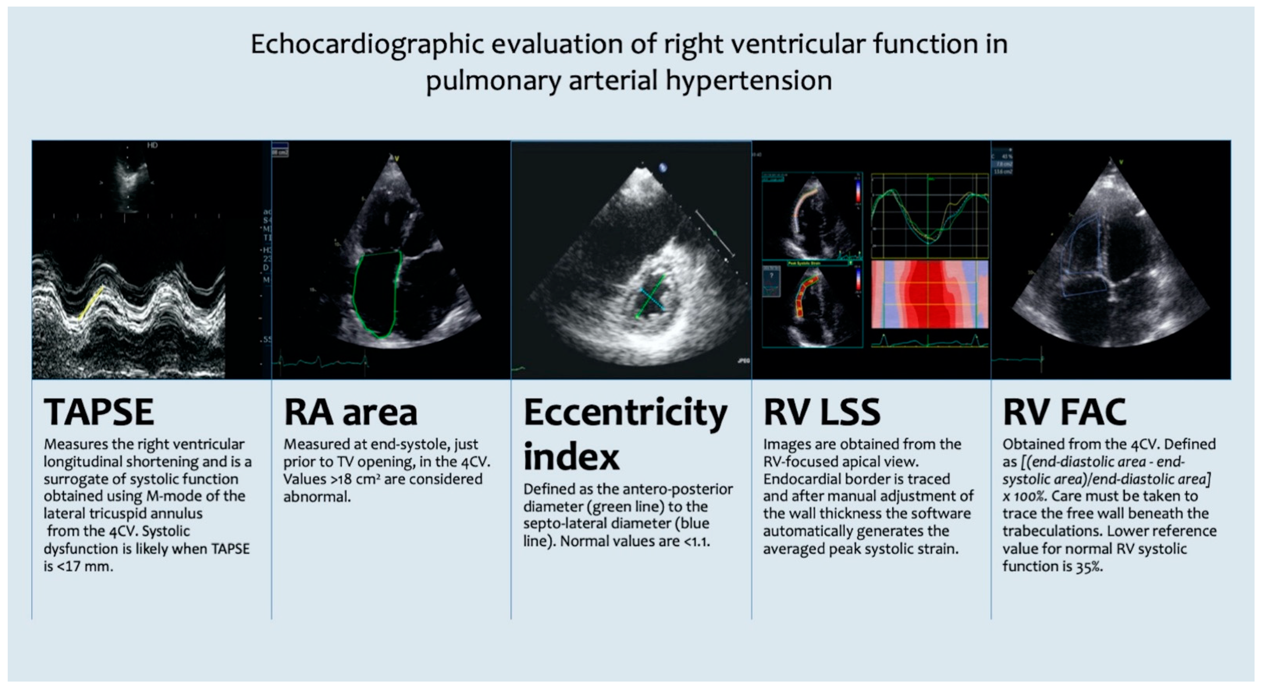 A method for direct estimation of left ventricular global