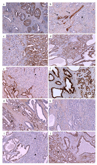 JCM | Free Full-Text | E-Cadherin, Integrin Alpha2 (Cd49b), and ...