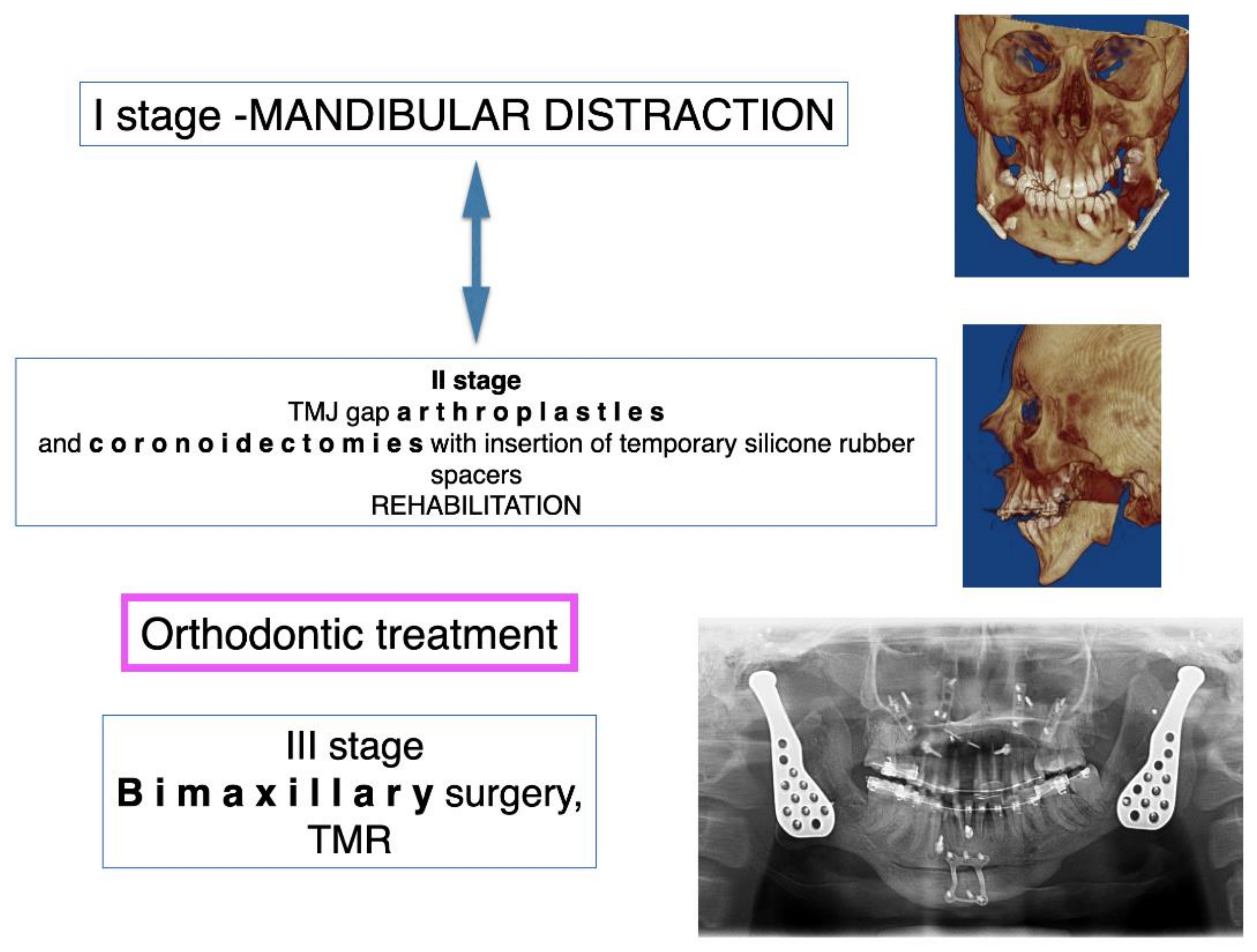 Jcm Free Full Text Protocol For Multi Stage Treatment Of