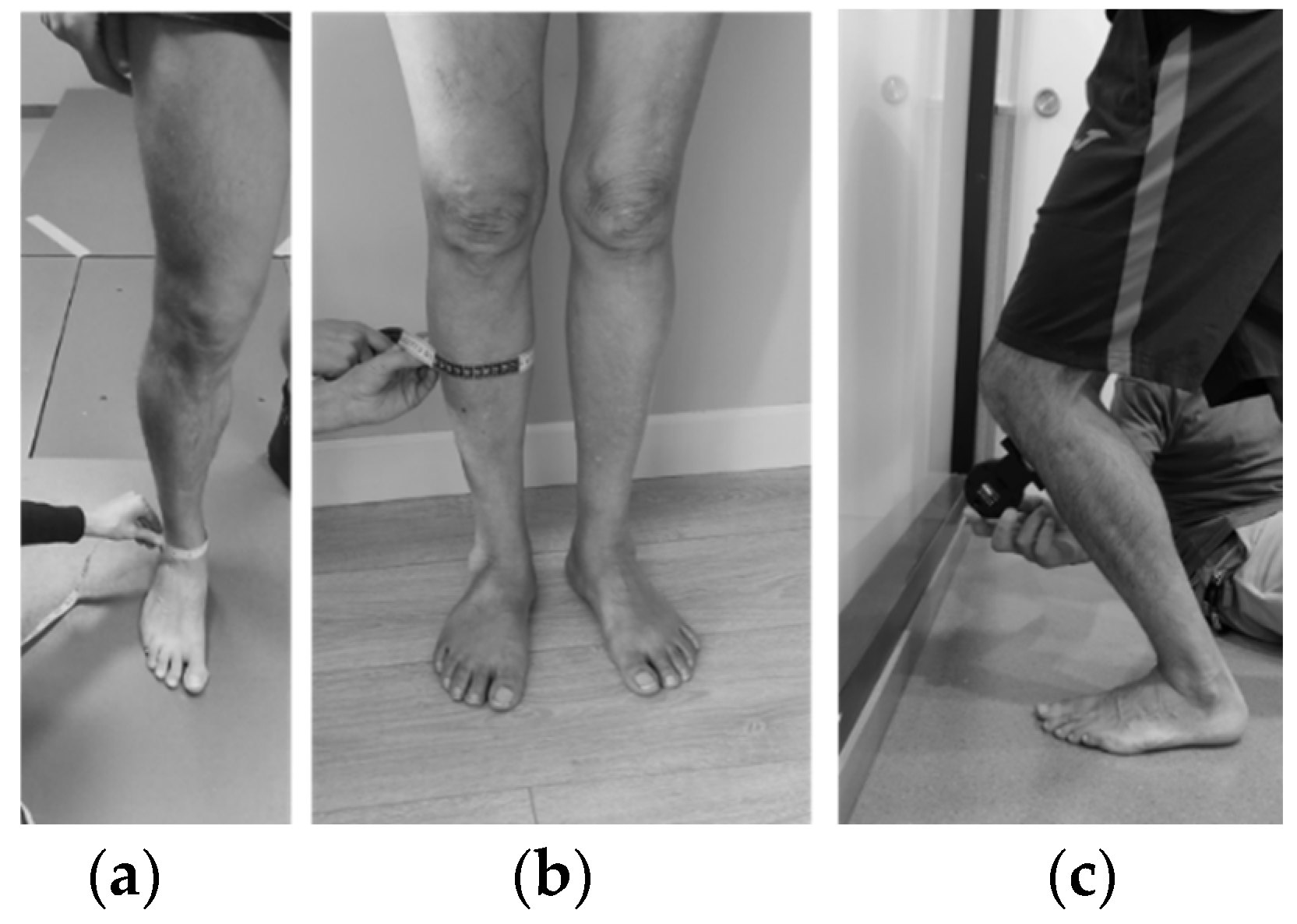 Early Weight-Bearing Following Ankle Fracture ORIF