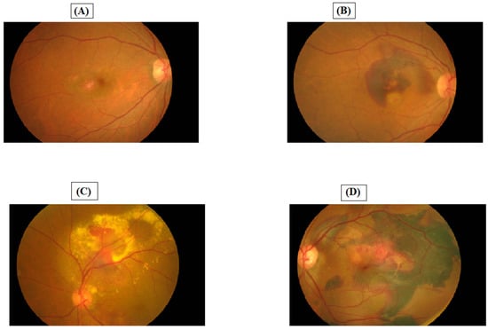 JCM | Free Full-Text | Current Trends in Clinical Characteristics ...