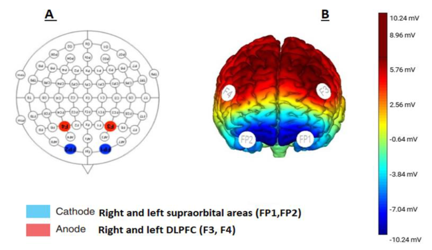 Frontiers  Randomized Controlled Study Evaluating Efficiency of Low  Intensity Transcranial Direct Current Stimulation (tDCS) for Dyspnea Relief  in Mechanically Ventilated COVID-19 Patients in ICU: The tDCS-DYSP-COVID  Protocol