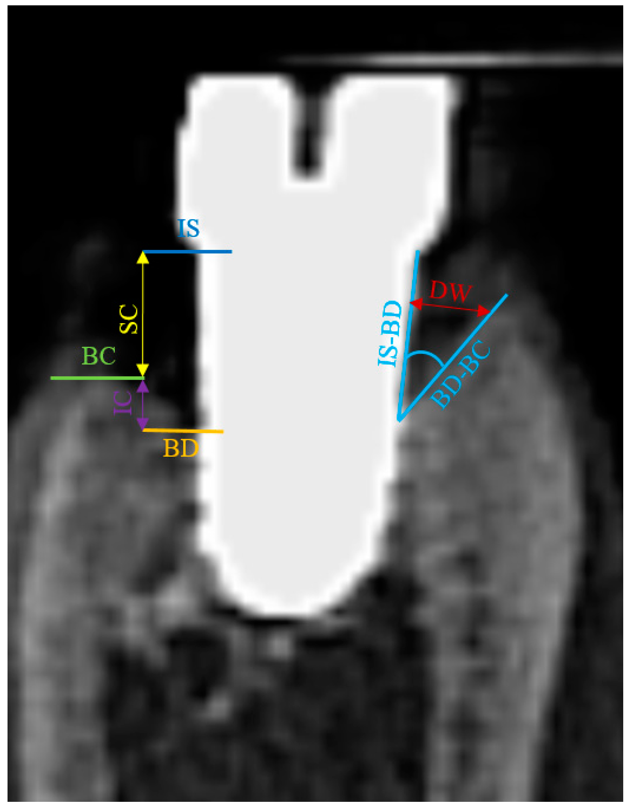 JCM | Free Full-Text | Histomorphometrical And CBCT Evaluation Of ...