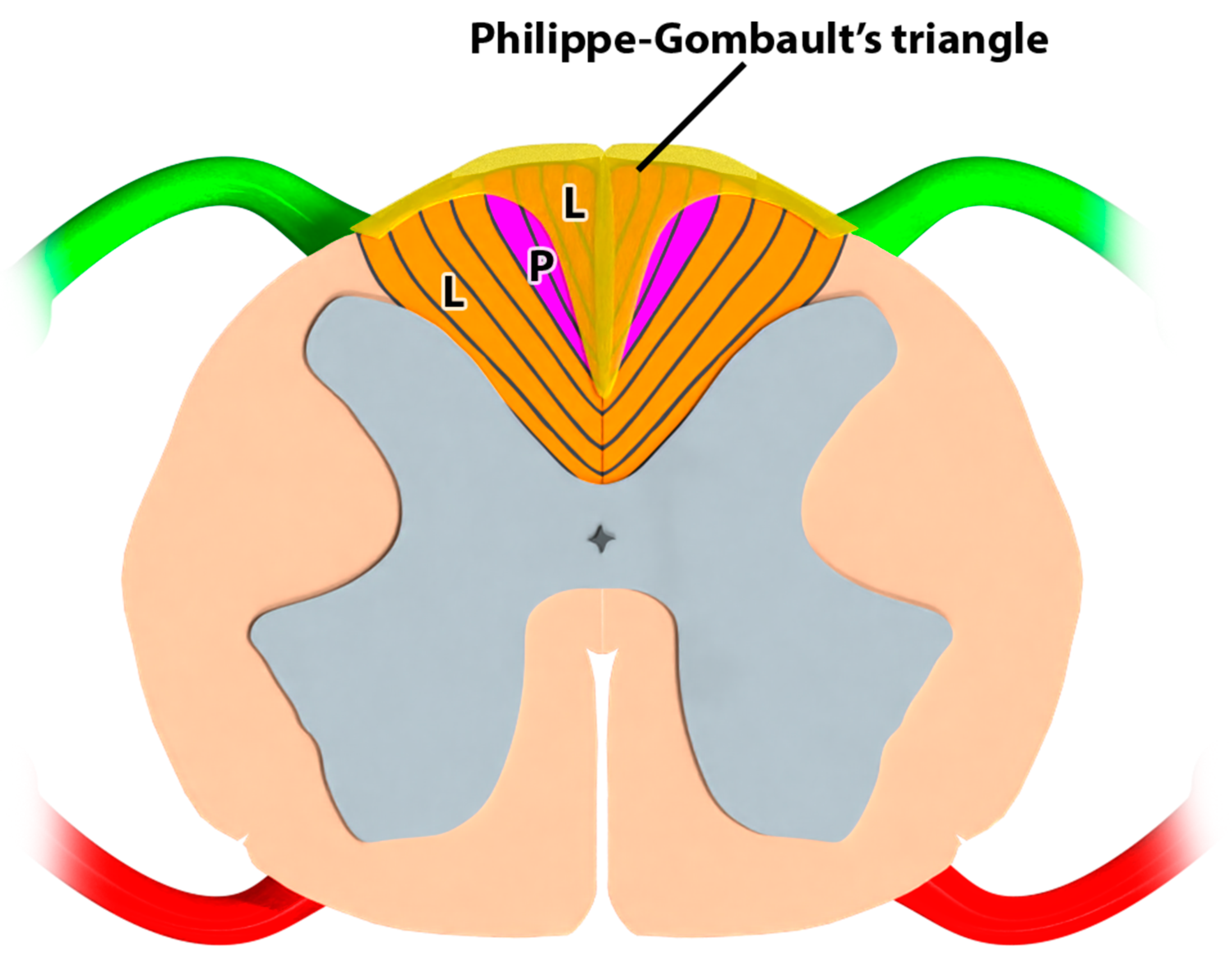 Neuromodulation (SCS/PNS) - Axis Spine Center