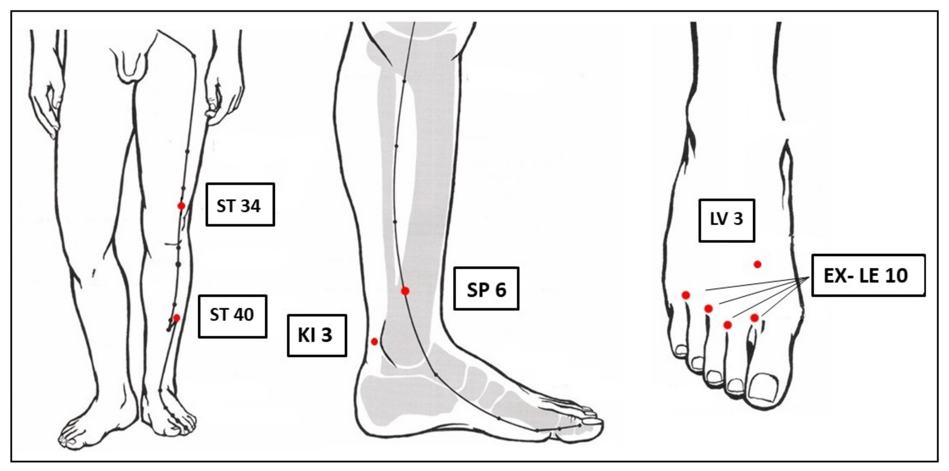 PDF) Acupuncture for the treatment of ankle sprain: A protocol for a  systematic review and meta-analysis