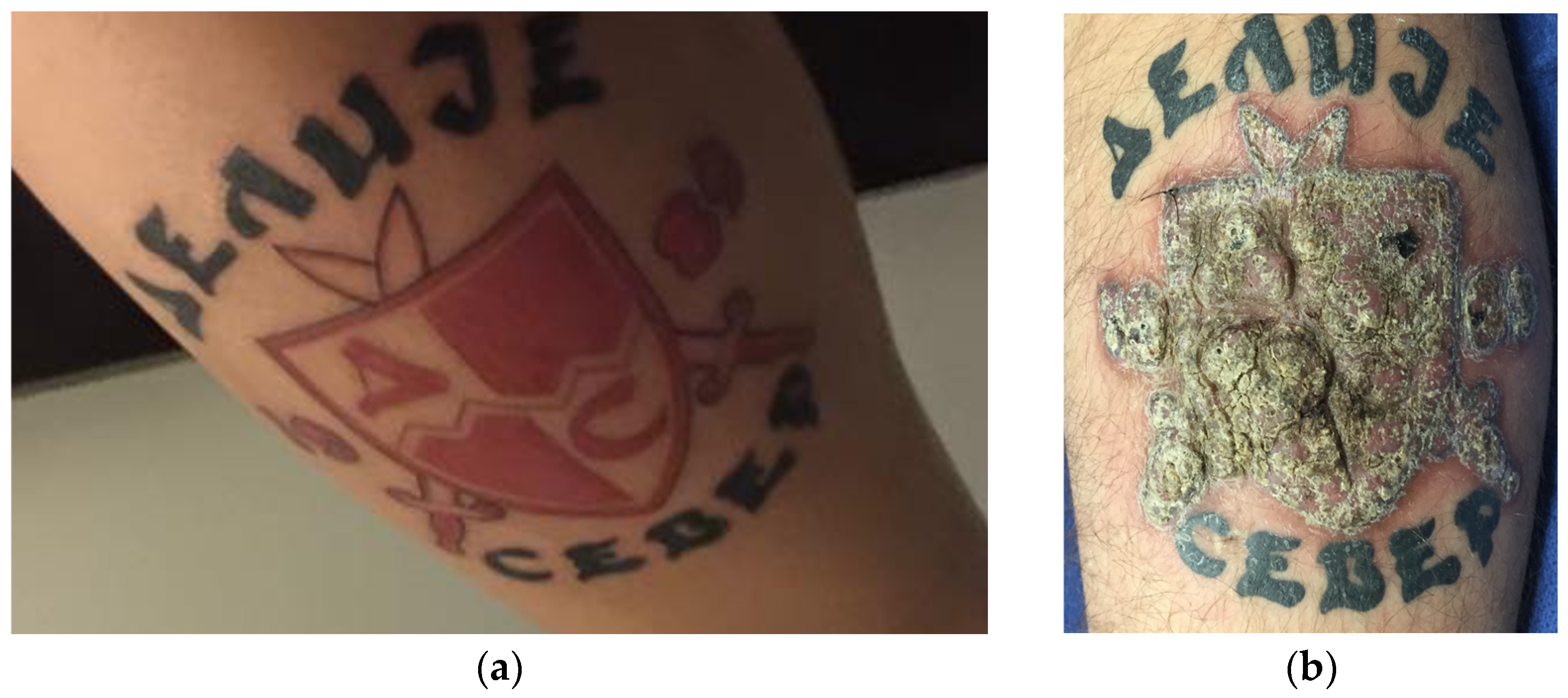Type 1 Diabetic Warrior Temporary Tattoo – Temporary Tattoos