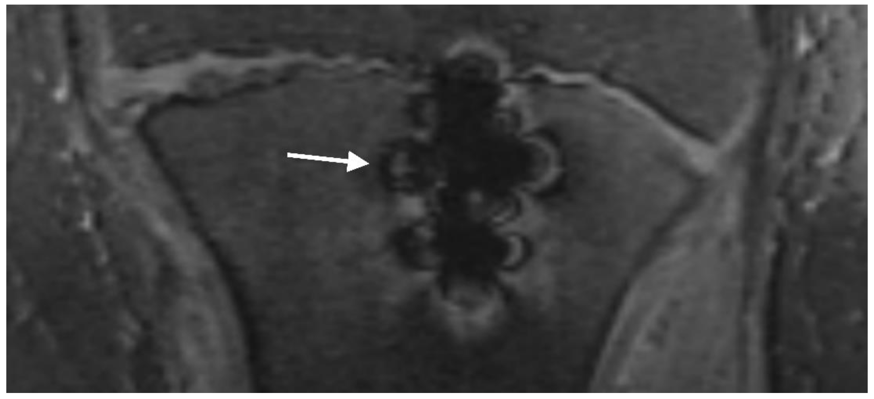 Jcm Free Full Text Prospective Evaluation Of Magnetic Resonance Imaging Features Of 