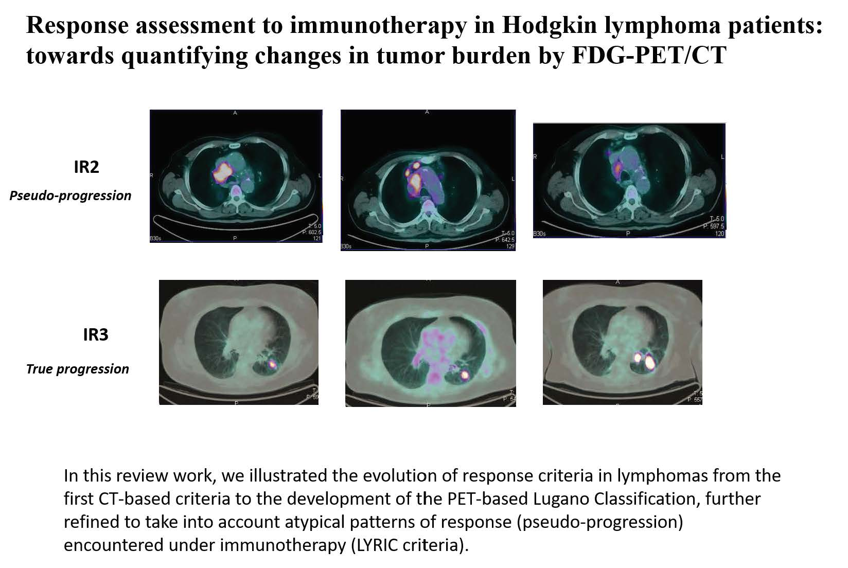 Jcm Free Full Text Assessment Of Response To Immunotherapy In