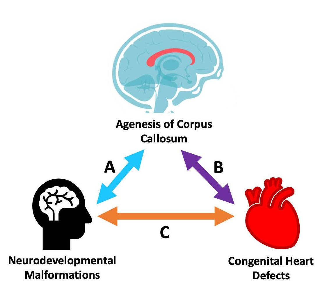 Corpus Callosum Corpus Callosum