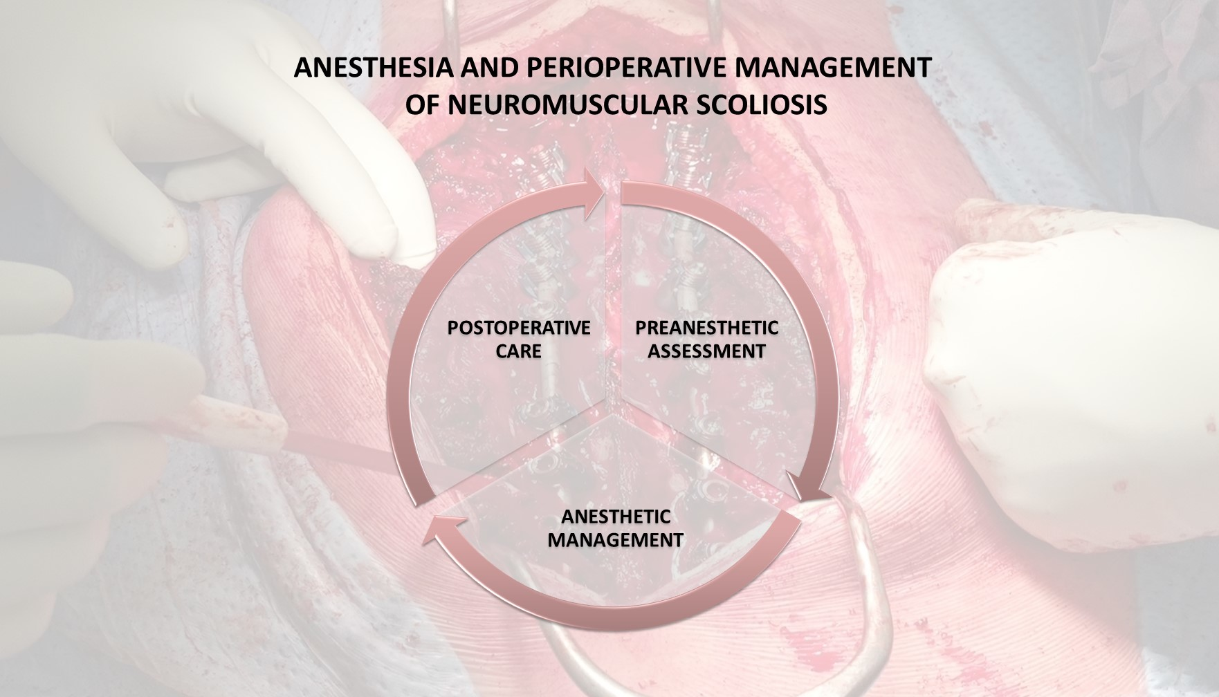 Mastering Anesthesia Management for Surgical Excellence