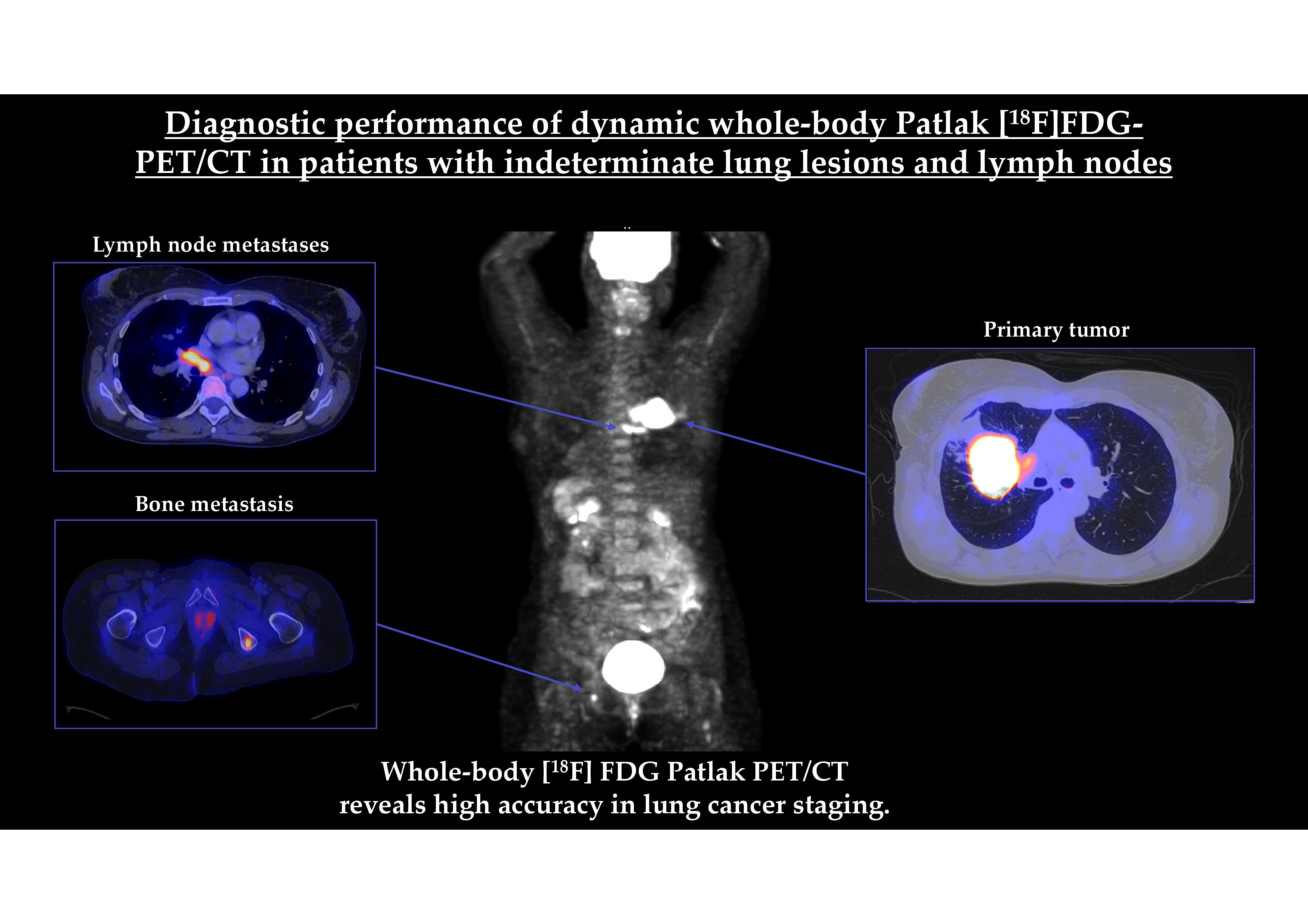 Advancing Whole-body Dynamic PET Imaging for Understanding Disease  Metabolism