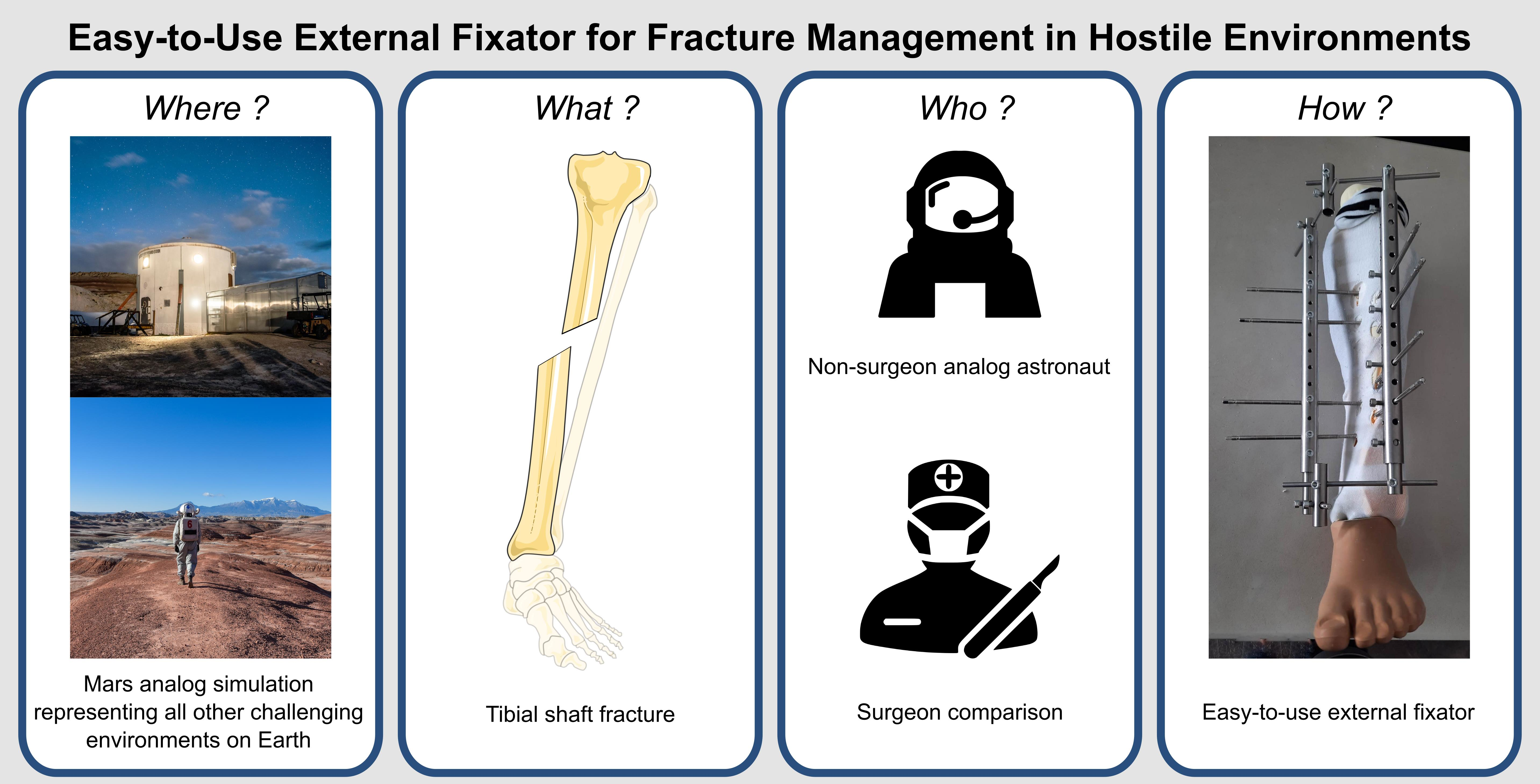 PDF] Functional Outcomes and Quality of Life Following Complex Tibial  Fractures Treated with Circular External Fixation: A Comparison between  Proximal, Midshaft, and Distal Tibial Fractures