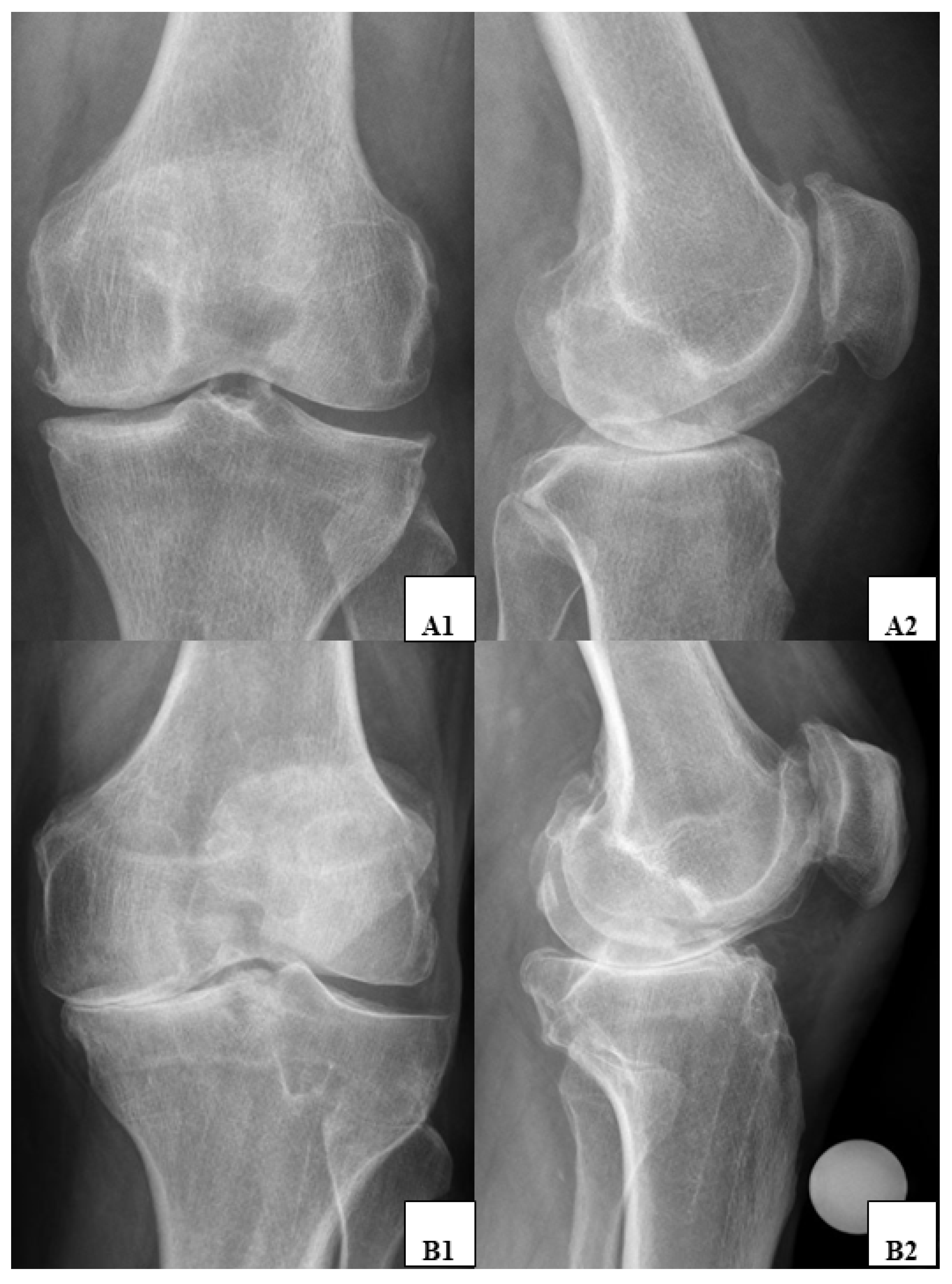 What Is The Correlation Between Clinical And Radiographic Findings In What Is The Correlation Between Clinical And Radiographic Findings In