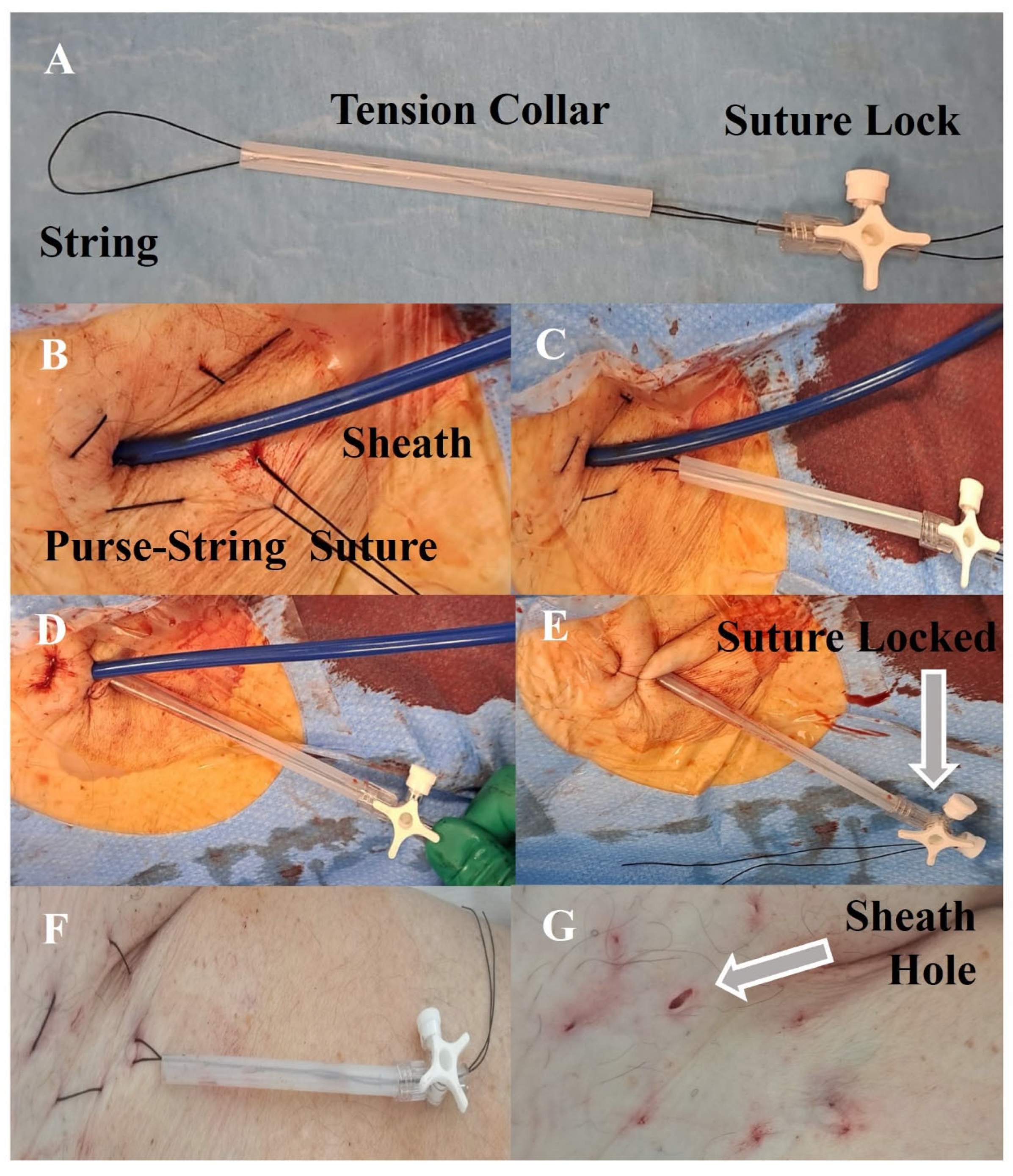 Common Suture Patterns - GynecolOncol